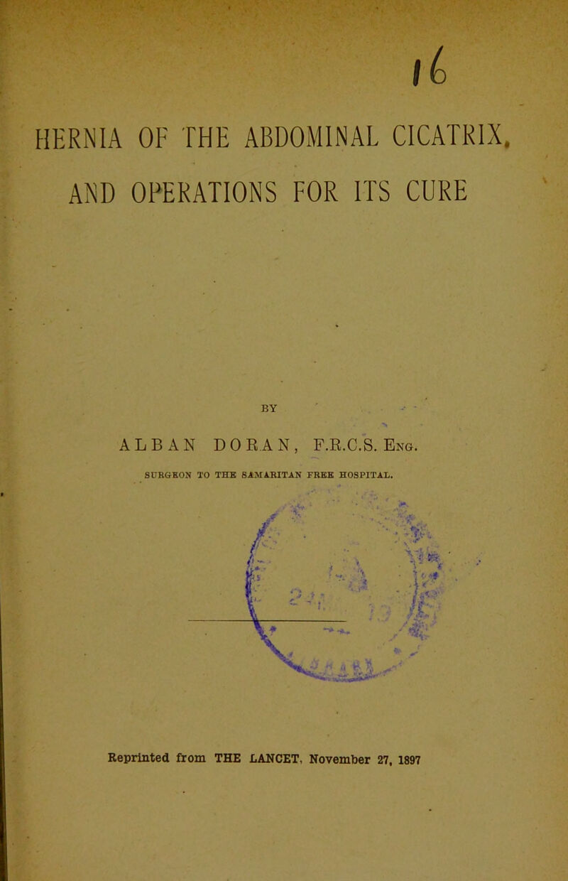 HERNIA OF THE ABDOMINAL CICATRIX, AND OPERATIONS FOR ITS CURE BY ALBAN DORAN, F.R.C.S. Eng. SURGEON TO THE SAMARITAN FREE HOSPITAL. Reprinted from THE EANCET, November 27, 1897