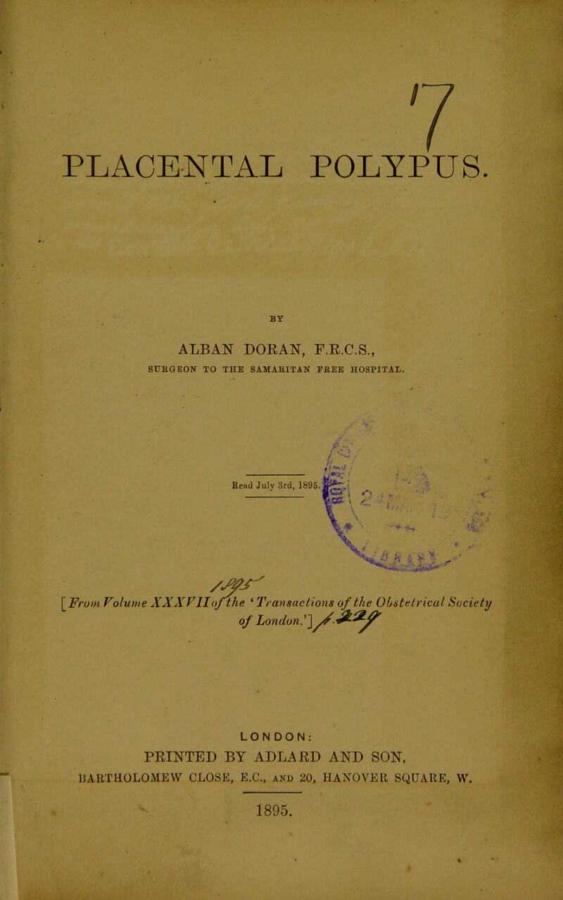 PLACENTAL POLYPUS BY ALBAN DORAN, F.R.C.S., SURGEON TO THE SAMAEITAN PEEE HOSPITAL. /MS' [From Volume XXXVIIof\the ‘ Transactions of the Obstetrical Society of London. LONDON: PRINTED BY ADLARD AND SON, ISARTHOLOMEW CLOSE, E.C., anb 20, HANOVER SQUARE, W.