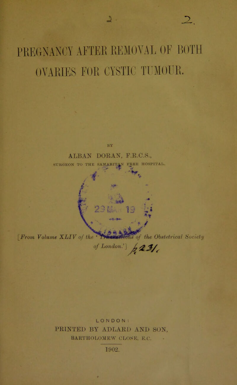 J • PREGNANCY AFTER REMOVAL OF BOTH OVARIES FOR CYSTIC TUMOUR. BY ALBAN DORAN, P.R.C.S., SURGEON TO THE SAMARITAN FREE HOSPITAL. / V ' r j ' f LONDON: PRINTED BY ADLARD AND SON, BARTHOLOMEW CLOSE, E.C. 1902.