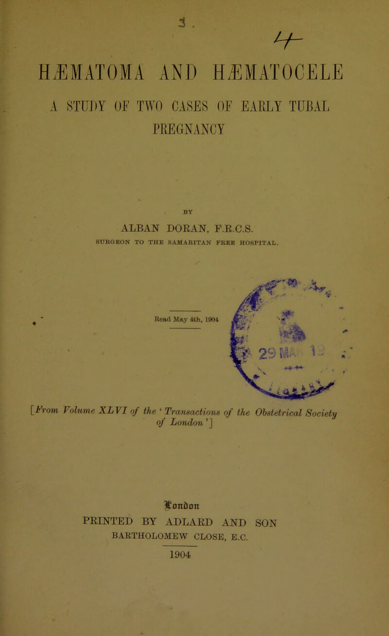 3. HiEMATOMA AND HEMATOCELE A STUDY OF TWO CASES OF EARLY TUBAL PREGNANCY BY ALBAN DORAN, F.R.C.S. SURGEON TO THE SAMARITAN FREE HOSPITAL. [ h rom Volume XL VI of the ‘ Transactions of the Obstetrical Society of London ’] Ionian PRINTED BY ADLARD AND SON BARTHOLOMEW CLOSE, E.C. 1904