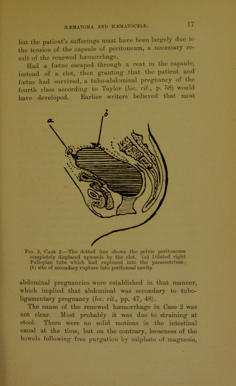 but the patient’s sufferings must have been largely due to the tension of the capsule of peritoneum, a necessary re- sult of the renewed haemorrhage. Had a foetus escaped through a rent in the capsule, instead of a clot, then granting that the patient and foetus had survived, a tubo-abdominal pregnancy of the fourth class according to Taylor (Zoc. cit., p. 58) would have developod. Earlier writers believed that most Fig. 2, Case 2.—The dotted line shows the pelvic peritoneum completely displaced upwards by the clot, (a) Dilated right Fallopian tube which had ruptured into the parametrium; (6) site of secondary rupture into peritoneal cavity. abdominal pregnancies were established in that manner, which implied that abdominal was secondary to tubo- ligamentary pregnancy (loc. cit., pp. 47, 48). The cause of the renewed haemorrhage in Case 2 was not clear. Most probably it was due to straining at stool. There were no solid motions in the intestinal canal at the time, but on the contrary, looseness of the bowels following free purgation by sulphate of magnesia,