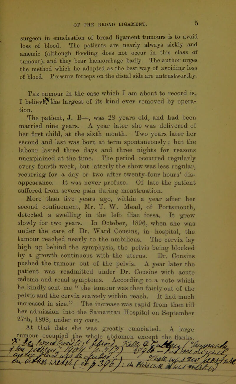 surgeon in enucleation of broad ligament tumours is to avoid loss of blood. The patients are nearly always sickly and ansemic (although flooding does not occur in this class of tumour), and they bear haemorrhage badly. The author urges the method which he adopted as the best way of avoiding loss of blood. Pressure forceps on the disial side are untrustworthy. The tumour in the case which I am about to record is, I believ&^the largest of its kind ever removed by opera- tion. The patient, J. B—, was 28 years old, and had been married nine years. A year later she was delivered of her first child, at the sixth month. Two years later her second and last was born at term spontaneously; but the labour lasted three days and three nights for reasons unexplained at the time. The period occurred regularly every fourth week, but latterly the show was less regular, recurring for a day or two after twenty-four hours5 dis- appearance. It was never profuse. Of late the patient suffered from severe pain during menstruation. More than five years ago, within a year after her second confinement, Mr. T. W. Mead, of Portsmouth, detected a swelling in the left iliac fossa. It grew slowly for two years. In October, 1896, when she was under the care of Dr. Ward Cousins, in hospital, the tumour reached nearly to the umbilicus. The cervix lay high up behind the symphysis, the pelvis being blocked by a growth continuous with the uterus. Dr. Cousins pushed the tumour out of the pelvis. A year later the patient was readmitted under Dr. Cousins with acute oedema and renal symptoms. According to a uote which he kindly sent me “ the tumour was then fairly out of the pelvis and the cervix scarcely within reach. It had much increased in size.55 The increase was rapid from then till her admission into the Samaritan Hospital on September 27th, 1898, under my care.