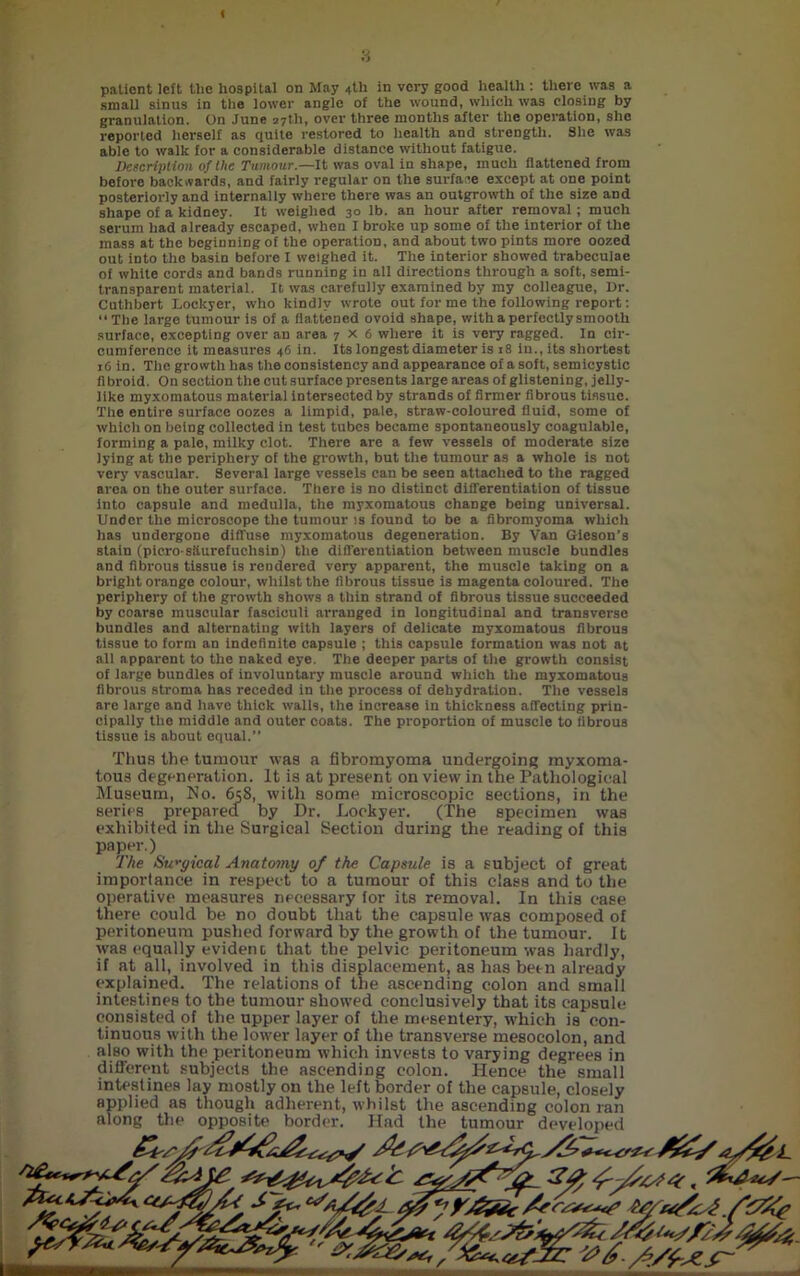 small sinus in the lower angle of the wound, which was closing by granulation. On June 27th, over three months after the operation, she reported herself as quite restored to health and strength. She was able to walk for a considerable distance without fatigue. Description of the Tumour.—It was oval in shape, much flattened from before backwards, and fairly regular on the surface except at one point posteriorly and internally where there was an outgrowth of the size and shape of a kidney. It weighed 30 lb. an hour after removal; much serum had already escaped, when I broke up some of the interior of the mass at the beginning of the operation, and about two pints more oozed out into the basin before I weighed it. The interior showed trabeculae of white cords and bands running in all directions through a soft, semi- transparent material. It was carefully examined by my colleague, Dr. Cuthbert Lockyer, who kindly wrote out for me the following report: “ The large tumour is of a flattened ovoid shape, with a perfectly smooth surface, excepting over an area 7X6 where it is very ragged. In cir- cumference it measures 46 in. Its longest diameter is 18 in., its shortest 16 in. The growth has the consistency and appearance of a soft, semicystic fibroid. On section the cut surface presents large areas of glistening, jelly- like myxomatous material intersected by strands of firmer fibrous tissue. The entire surface oozes a limpid, pale, straw-coloured fluid, some of which on being collected in test tubes became spontaneously coagulable, forming a pale, milky clot. There are a few vessels of moderate size lying at the periphery of the growth, but the tumour as a whole is not very vascular. Several large vessels can be seen attached to the ragged area on the outer surface. There is no distinct differentiation of tissue into capsule and medulla, the myxomatous change being universal. Under the microscope the tumour is found to be a fibromyoma which has undergone diffuse myxomatous degeneration. By Van Gieson’s stain (picro-stturefuclisin) the differentiation between muscle bundles and fibrous tissue is rendered very apparent, the muscle taking on a bright orange colour, whilst the fibrous tissue is magenta coloured. The periphery of the growth shows a thin strand of fibrous tissue succeeded by coarse muscular fasciculi arranged in longitudinal and transverse bundles and alternating with layers of delicate myxomatous fibrous tissue to form an indefinite capsule ; this capsule formation was not at all apparent to the naked eye. The deeper parts of the growth consist of large bundles of involuntary muscle around which the myxomatous fibrous stroma has receded in the process of dehydration. The vessels are large and have thick walls, the increase in thickness affecting prin- cipally the middle and outer coats. The proportion of muscle to fibrous tissue is about equal.” Thus the tumour was a fibromyoma undergoing myxoma- tous degeneration. It is at present on view in the Pathological Museum, No. 658, with some microscopic sections, in the series prepared by Dr. Lockyer. (The specimen was exhibited in the Surgical Section during the reading of this paper.) The Surgical Anatomy of the Capsule is a subject of great importance in respect to a tumour of this class and to the operative measures necessary for its removal. In this case there could be no doubt that the capsule rvas composed of peritoneum pushed forward by the growth of the tumour. It was equally evident that the pelvic peritoneum was hardly, if at all, involved in this displacement, as has been already explained. The relations of the ascending colon and small intestines to the tumour showed conclusively that its capsule consisted of the upper layer of the mesentery, which is con- tinuous with the lower layer of the transverse mesocolon, and also with the peritoneum which invests to varying degrees in different subjects the ascending colon. Hence the small intestines lay mostly on the left border of the capsule, closely applied as though adherent, whilst the ascending colon ran along the opposite border. Had the tumour developed r''