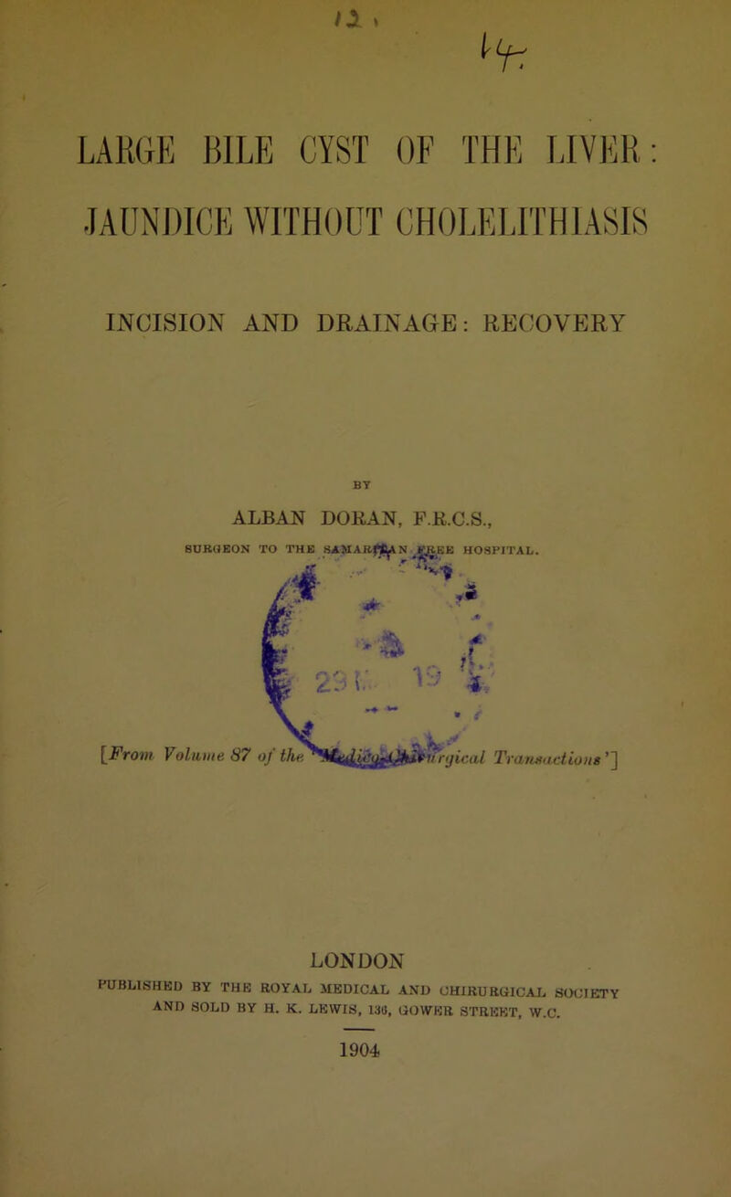 LARGE BILE CYST OF THE LIVER JAUNDICE WITHOUT CHOLELITHIASIS INCISION AND DRAINAGE: RECOVERY BY ALBAN DORAN, F.R.C.S., LONDON PUBLISHED BY THE ROYAL MEDICAL AND CHIRURGICAL SOCIETY AND SOLD BY H. K. LEWIS, 13(5, GOWER STREET, W.C.