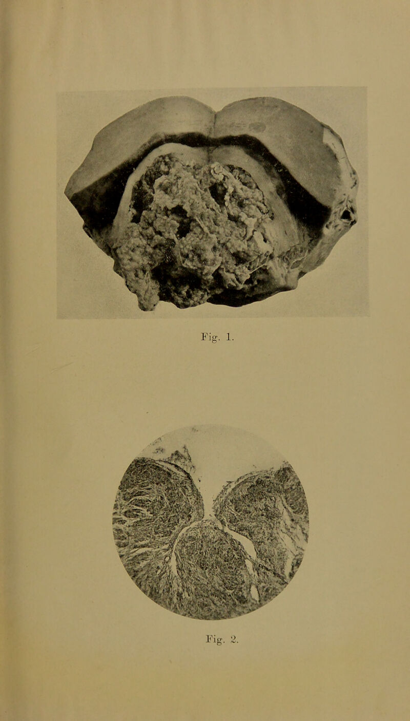 Fig. 1. Fig. 2.