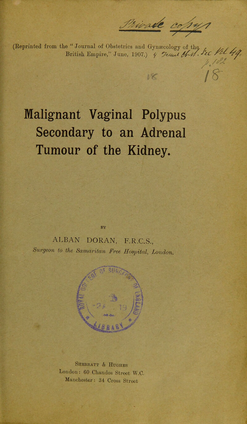 (Eeprinted from tlie “ Journal of Obstetrics and Gynaecology of tba , y British Empire,” June, 1907.) ^ r IS~ Malignant Vaginal Polypus Secondary to an Adrenal Tumour of the Kidney. ALBAN DORAN, F.R.C.S., Surgeon to the Samaritan Free Ifospital, London. Sherratt & Huohes London: 60 Chandos Street W.C. Manchester: 34 Cross Street