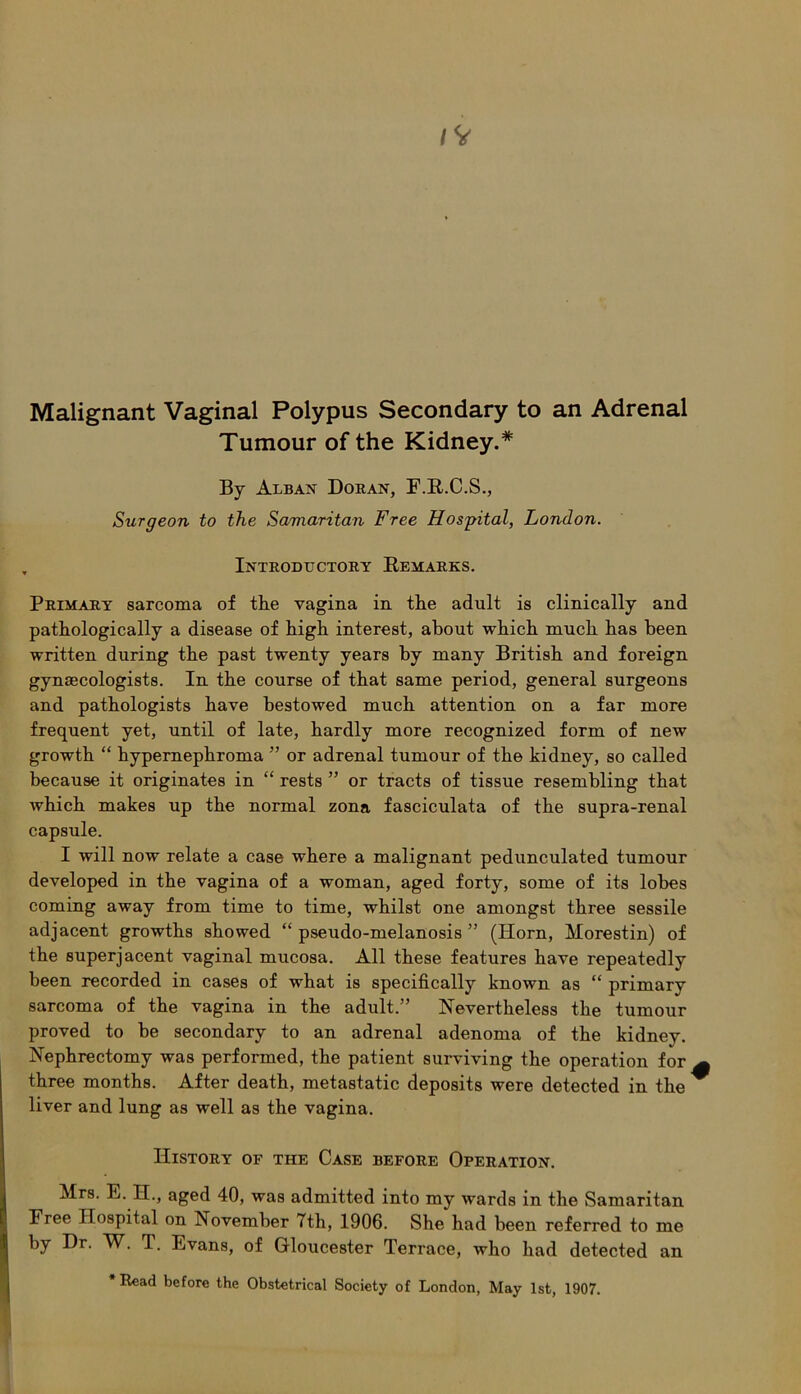 Malignant Vaginal Polypus Secondary to an Adrenal Tumour of the Kidney.* By Alban Doran, I’.R.C.S., Surgeon to the Samaritan Free Hospital, London. Introdlctory Remarks. Primary sarcoma of the vagina in the adult is clinically and pathologically a disease of high interest, about which much has been written during the past twenty years by many British and foreign gynaecologists. In the course of that same period, general surgeons and pathologists have bestowed much attention on a far more frequent yet, until of late, hardly more recognized form of new growth “ hypernephroma ” or adrenal tumour of the kidney, so called because it originates in “ rests ” or tracts of tissue resembling that which makes up the normal zona fasciculata of the supra-renal capsule. I will now relate a case where a malignant pedunculated tumour developed in the vagina of a woman, aged forty, some of its lobes coming away from time to time, whilst one amongst three sessile adjacent growths showed “ pseudo-melanosis ” (Horn, Morestin) of the superjacent vaginal mucosa. All these features have repeatedly been recorded in cases of what is specifically known as “ primary sarcoma of the vagina in the adult.” Nevertheless the tumour proved to be secondary to an adrenal adenoma of the kidney. Nephrectomy was performed, the patient surviving the operation for three months. After death, metastatic deposits were detected in the liver and lung as well as the vagina. # History of the Case before Operation. Mrs. E. H., aged 40, was admitted into my wards in the Samaritan Free Hospital on November 7th, 1906. She had been referred to me by Dr. W. T. Evans, of Gloucester Terrace, who had detected an * Read before the Obstetrical Society of London, May 1st, 1907.