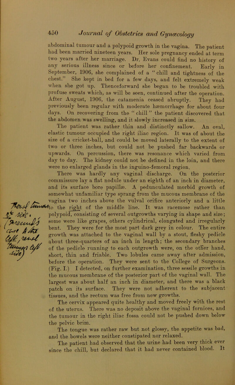 abdominal tumour and a polypoid growth in the vagina. The patient had been married nineteen years. Her sole pregnancy ended at term two years after her marriage. Dr. Evans could find no history of any serious illness since or before her confinement. Early in September, 1906, she complained of a “ chill and tightness of the chest.” She kept in bed for a few days, and felt extremely weak when she got up. Thenceforward she began to be troubled with profuse sweats which, as will be seen, continued after the operation. After August, 1906, the catamenia ceased abruptly. They had previously been regular with moderate haemorrhage for about four days. On recovering from the “ chill ” the patient discovered that the abdomen was swelling, and it slowly increased in size. The patient was rather thin and distinctly sallow. An oval, elastic tumour occupied the right iliac region. It was of about the size of a cricket-ball, and could be moved laterally to the extent of two or three inches, but could not be pushed far backwards or upwards. On percussion, there was resonance which varied from day to day. The kidney could not be defined in the loin, and there were no enlarged glands in the inguino-femoral region. There was hardly any vaginal discharge. On the posterior commissure lay a flat nodule under an eighth of an inch in diameter, and its surface bore papillae. A pedunculated morbid growth of somewhat unfamiliar type sprang from the mucous membrane of the ^ ^ vagina two inches above the vulval orifice anteriorly and a little the right of the middle line. It was racemose rather than * polypoid, consisting of several outgrowths varying in shape and size; / some were like grapes, others cylindrical, elongated and irregularly bent. They were for the most part dark grey in colour. The entire growth was attached to the vaginal wall by a stout, fleshy pedicle about three-quarters of an inch in length; the secondary branches of the pedicle running to each outgrowth were, on the other hand, short, thin and friable. Two lobules came away after admission, before the operation. They were sent to the College of Surgeons. (Fig. I.) I detected, on further examination, three sessile growths in the mucous membrane of the posterior part of the vaginal wall. The largest was about half an inch in diameter, and there was a black patch on its surface. They were not adherent to the subjacent tissues, and the rectum was free from new growths. The cervix appeared quite healthy and moved freely with the rest of the uterus. There was no deposit above the vaginal fornices, and the tumour in the right iliac fossa could not be pushed down below the pelvic brim. The tongue was rather raw but not glossy, the appetite was bad, and the bowels were neither constipated nor relaxed. The patient had observed that the urine had been very thick ever since the chill, but declared that it had never contained blood. It