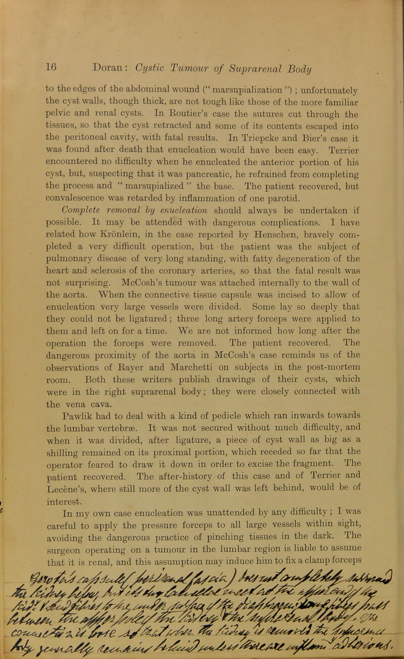 Doran: Cystic Tumour of Suprarenal Body to the edges of the abdominal wound (“ marsupialization ”); unfortunately the cyst walls, though thick, are not tough like those of the more familiar pelvic and renal cysts. In lloutier’s case the sutures cut through the tissues, so that the cyst retracted and some of its contents escaped into the peritoneal cavity, with fatal results. In Triepcke and Bier’s case it was found after death that enucleation would have been easy. Terrier encountered no difficulty when he enucleated the anterior portion of his cyst, but, suspecting that it was pancreatic, he refrained from completing the process and “ marsupialized ” the base. The patient recovered, but convalescence was retarded by inflammation of one parotid. Complete removal hy enucleation should always be undertaken if possible. It may be attended with dangerous complications. I have related how Kronlein, in the case reported by Henschen, bravely com- pleted a very difficult operation, but the patient was the subject of pulmonary disease of very long standing, with fatty degeneration of the heart and sclerosis of the coronary arteries, so that the fatal result was not surprising. McCosh’s tumour was attached internally to the wall of the aorta. When the connective tissue capsule was incised to allow of enucleation very large vessels were divided. Some lay so deeply that they could not be ligatured; three long artery forceps were applied to them and left on for a time. We are not informed how long after the operation the forceps were removed. The patient recovered. The dangerous proximity of the aorta in McCosh’s case reminds us of the observations of Rayer and Marchetti on subjects in the post-mortem room. Both these writers publish drawings of their cysts, which were in the right suprarenal body; they were closely connected with the vena cava. Pawlik had to deal with a kind of pedicle which ran inwards towards the lumbar vertebrae. It was not secured without much difficulty, and when it was divided, after ligature, a piece of cyst wall as big as a shilling remained on its proximal portion, which receded so far that the operator feared to draw it down in order to excise the fragment. The patient recovered. The after-history of this case and of Terrier and Lecene’s, where still more of the cyst wall was left behind, would be of interest. In my own case enucleation was unattended by any difficulty ; I was careful to apply the pressure forceps to all large vessels within sight, avoiding the dangerous practice of pinching tissues in the dark. The surgeon operating on a tumour in the lumbar region is liable to assume that it is renal, and this assumption may induce him to fix a clamp forceps y '