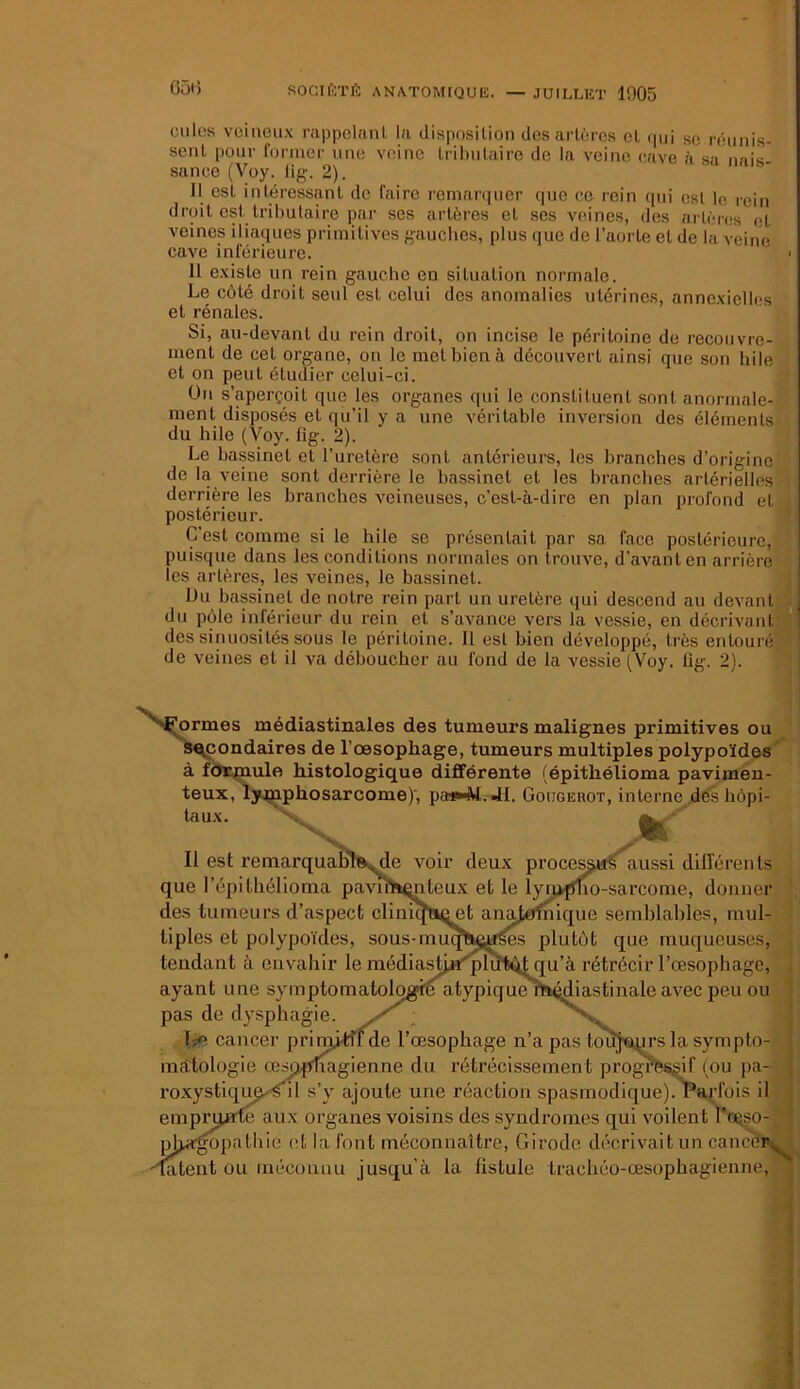 . 056 SOCIÉTÉ ANATOMIQUE. — JUILLET 1905 tuiles veineux rappelant la disposition des artères et qni so réunis- sent pour former une veine tributaire de la veine cave à sa nais- sance (Voy. fig. 2). 11 est intéressant de faire remarquer que ce rein qui est le rein droit est tributaire par ses artères et ses veines, des artères et veines iliaques primitives gauches, plus que de l’aorte et de la veine cave inférieure. Il existe un rein gauche en situation normale. Le côté droit seul est celui des anomalies utérines, annexielles et rénales. Si, au-devant du rein droit, on incise le péritoine de recouvre- ment de cet organe, on le met bien à découvert ainsi que son hile et on peut étudier celui-ci. On s’aperçoit que les organes qui le constituent sont anormale- ment disposés et qu’il y a une véritable inversion des éléments du hile (Voy. fig. 2). Le bassinet et l’uretère sont antérieurs, les branches d’origine de la veine sont derrière le bassinet et les branches artérielles derrière les branches veineuses, c’est-à-dire en plan profond et postérieur. C'est comme si le hile se présentait par sa face postérieure, puisque dans les conditions normales on trouve, d'avant en arrière les artères, les veines, le bassinet. Du bassinet de notre rein part un uretère qui descend au devant du pôle inférieur du rein et s’avance vers la vessie, en décrivant des sinuosités sous le péritoine. Il est bien développé, très entouré de veines et il va déboucher au fond de la vessie (Voy. fig. 2). •’ormes médiastinales des tumeurs malignes primitives ou a,condaires de l’oesophage, tumeurs multiples polypoïdes à formule histologique différente (épithélioma pavimen- teux, lymphosarcome)', pasMVL JL Goijgehot, interne des hôpi- taux. s. Il est remarquable, de voir deux processifs aussi différents que l’épithélioma pavimqnteux et le lympho-sarcome, donner des tumeurs d’aspect cliniquqet anajxnnique semblables, mul- tiples et polypoïdes, sous-muqlten^es plutôt que muqueuses, tendant à envahir le médiastjji'plütQt qu’à rétrécir l’œsophage, ayant une symptomatologie atypique médiastinale avec peu ou pas de dysphagie. fœ cancer prinp-tîf de l’œsophage n’a pas toùjoprs la sympto- matologie œsophagienne du rétrécissement progressif (ou pa- roxystiqu^s il s’y ajoute une réaction spasmodique). Parfois il emprunte aux organes voisins des syndromes qui voilent l’œso- jopathie et la font méconnaître, Girode décrivait un cance fatent ou méconnu jusqu’à la fistule trachéo-œsophagienne,