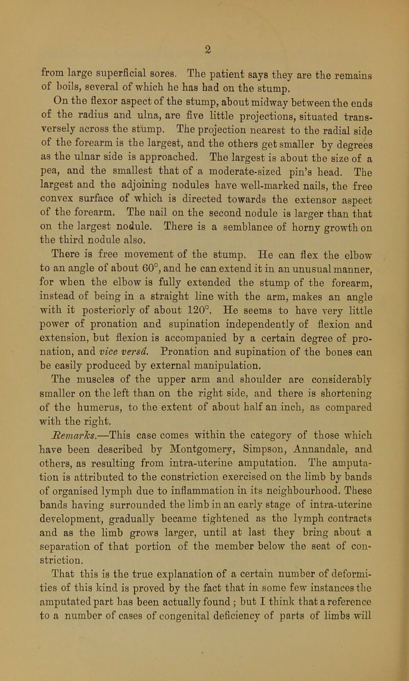 from large superficial sores. The patient says they are the remains of boils, several of which he has had on the stump. On the flexor aspect of the stump, about midway between the ends of the radius and ulna, are five little projections, situated trans- versely across the stump. The projection nearest to the radial side of the forearm is the largest, and the others get smaller by degrees as the ulnar side is approached. The largest is about the size of a pea, and the smallest that of a moderate-sized pin’s head. The largest and the adjoining nodules have well-marked nails, the free convex surface of which is directed towards the extensor aspect of the forearm. The nail on the second nodule is larger than that on the largest nodule. There is a semblance of horny growth on the third nodule also. There is free movement of the stump. He can flex the elbow to an angle of about 60°, and he can extend it in an unusual manner, for when the elbow is fully extended the stump of the forearm, instead of being in a straight line with the arm, makes an angle with it posteriorly of about 120°. He seems to have very little power of pronation and supination independently of flexion and extension, but flexion is accompanied by a certain degree of pro- nation, and vice versd. Pronation and supination of the bones can be easily produced by external manipulation. The muscles of the upper arm and shoulder are considerably smaller on the left than on the right side, and there is shortening of the humerus, to the extent of about half an inch, as compared with the right. Remarks.—This case comes within the category of those which have been described by Montgomery, Simpson, Annandale, and others, as resulting from intra-uterine amputation. The amputa- tion is attributed to the constriction exercised on the limb by bands of organised lymph due to inflammation in its neighbourhood. These bands having surrounded the limb in an early stage of intra-uterine development, gradually became tightened as the lymph contracts and as the limb grows larger, until at last they bring about a separation of that portion of the member below the seat of con- striction. That this is the true explanation of a certain number of deformi- ties of this kind is proved by the fact that in some few instances the amputated part has been actually found ; but I think that a reference to a number of cases of congenital deficiency of parts of limbs will