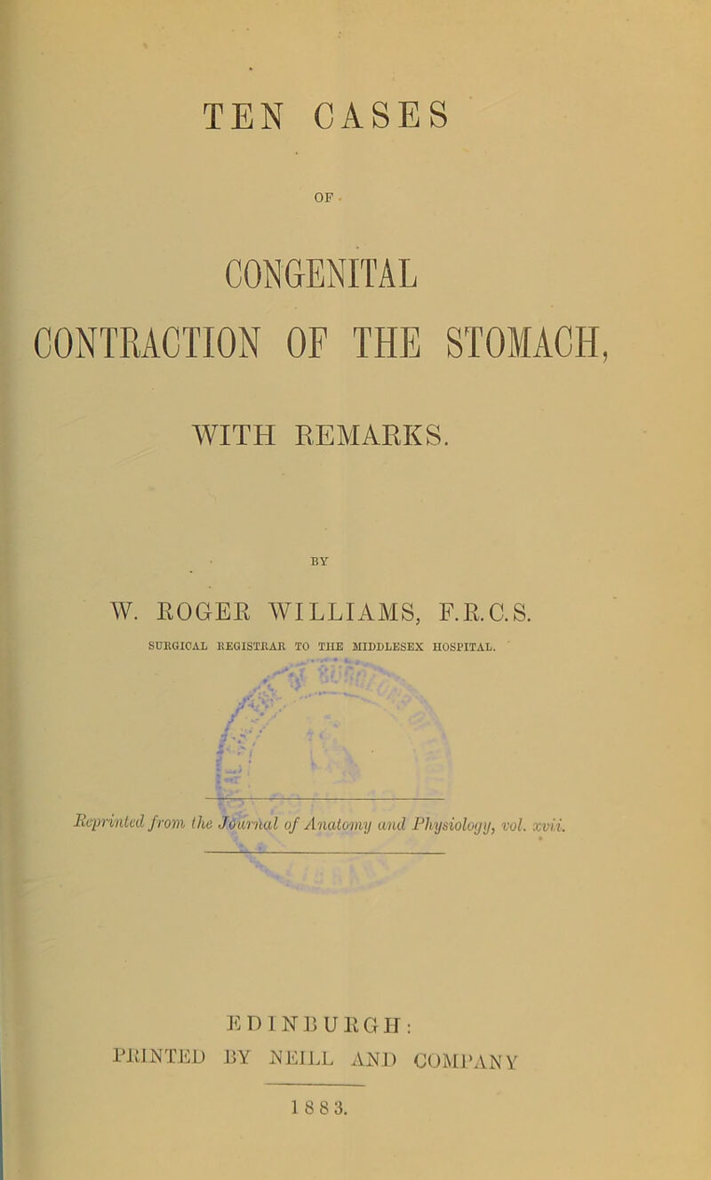 TEN CASES OF • CONGENITAL CONTRACTION OF THE STOMACH, WITH REMARKS. BY W. ROGER WILLIAMS, F.R.C.S. SURGICAL REGISTRAR TO THE MIDDLESEX HOSPITAL. Reprinted from the Journal of Anatomy and Physiology, vol. xvii. E D 1 NBURGH: PHINTED HY NEILL AND COMPANY 1 883.