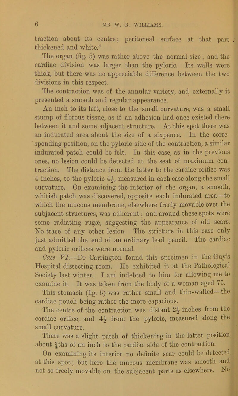 traction about its centre; peritoneal surface at that part thickened and white.” The organ (fig. 5) was rather above the normal size; and the cardiac division was larger than the pyloric. Its walls were thick, but there was no appreciable difference between the two divisions in this respect. The contraction was of the annular variety, and externally it presented a smooth and regular appearance. An inch to its left, close to the small curvature, was a small stump of fibrous tissue, as if an adhesion had once existed there between it and some adjacent structure. At this spot there was an indurated area about the size of a sixpence. In the corre- ’ spondiug position, on the pyloric side of the contraction, a similar indurated patch could be felt. In this case, as in the previous ones, no lesion could be detected at the seat of maximum con- traction. The distance from the latter to the cardiac orifice was 4 inches, to the pyloric 4£, measured in each case along the small curvature. On examining the interior of the organ, a smooth, whitish patch was discovered, opposite each indurated area—to which the mucous membrane, elsewhere freely movable over the subjacent structures, was adherent; and around these spots were some radiating rugge, suggesting the appearance of old scars. No trace of any other lesion. The stricture in this case only just admitted the end of an ordinary lead pencil. The cardiac and pyloric orifices were normal. Case VI.—Dr Carrington found this specimen in the Guy’s Hospital dissecting-room. He exhibited it at the Pathological Society last winter. I am indebted to him for allowing me to examine it. It was taken from the body of a woman aged 75. This stomach (fig. 6) was rather small and thin-walled—the cardiac pouch being rather the more capacious. The centre of the contraction was distant inches from the cardiac orifice, and 4£ from the pyloric, measured along the small curvature. There was a slight patch of thickening in the latter position about |ths of an inch to the cardiac side of the contraction. On examining its interior no definite scar could be detected at this spot; but here the mucous membrane was smooth and not so freely movable on the subjacent parts as elsewhere. No