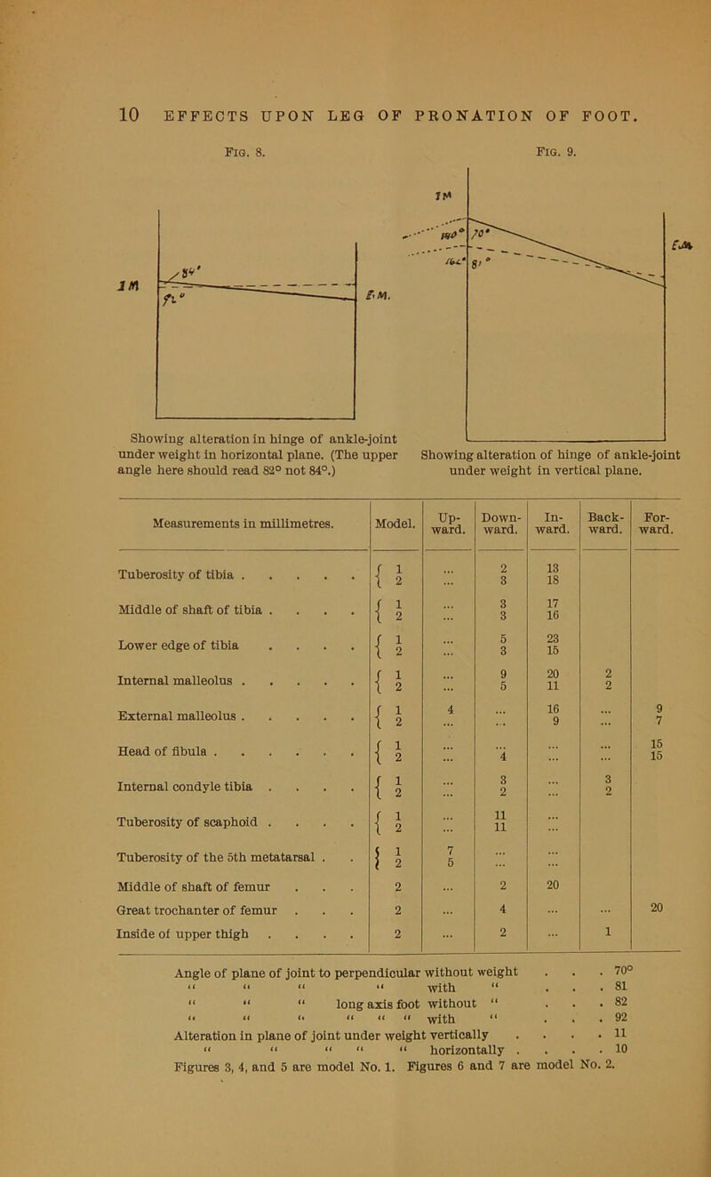 Fig. 8. Fig. 9. angle here should read 82° not 84°.) under weight in vertical plane. Measurements in millimetres. Model. Up- ward. Down- ward. In- ward. Back- ward. For- ward. Tuberosity of tibia { 5 2 3 13 18 Middle of shaft of tibia .... { 5 3 3 17 16 Lower edge of tibia .... { 5 5 3 23 15 Internal malleolus { i 9 5 20 11 2 2 External malleolus { i 4 16 9 9 7 Head of fibula { i 4 15 15 Internal condyle tibia .... { 5 3 2 3 2 Tuberosity of scaphoid .... { 1 11 11 Tuberosity of the 5th metatarsal . I i 7 5 Middle of shaft of femur 2 2 20 Great trochanter of femur 2 ... 4 20 Inside of upper thigh .... 2 ... 2 1 Angle of plane of joint to perpendicular without weight . . . 70° i* *< “ with 11 ... 81 “ “ “ long axis foot without “ . . .82 « <• i. a a a with “ . . .92 Alteration in plane of joint under weight vertically . . . .11 “ “ “ “ “ horizontally . . . .10 Figures 3, 4, and 5 are model No. 1. Figures 6 and 7 are model No. 2.