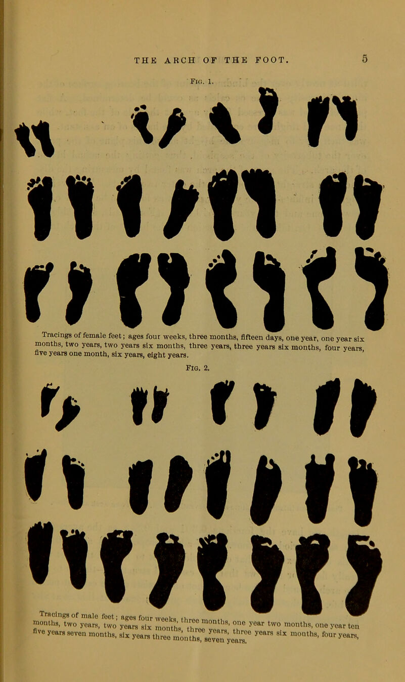 Fig. 1. « o \> ft HOII f» Tracings of female feet; ages four weeks, three months, fifteen days, one year, one year s.^ months, two years, two years six months, three years, three years six months, four years five years one month, six years, eight years. Fig. 2. r> n ft It Nfi w i months, two years, two’ years six h-''th°e year tW° ,nonths- one year ten five years seven months, six yearn three months' siren yearn!6 ***** ^ ^ *****’