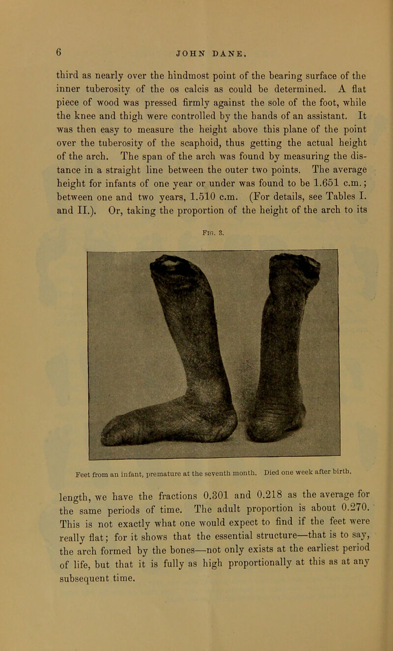 third as nearly over the hindmost point of the bearing surface of the inner tuberosity of the os calcis as could be determined. A flat piece of wood was pressed firmly against the sole of the foot, while the knee and thigh were controlled by the hands of an assistant. It was then easy to measure the height above this plane of the point over the tuberosity of the scaphoid, thus getting the actual height of the arch. The span of the arch was found by measuring the dis- tance in a straight line between the outer two points. The average height for infants of one year or under was found to be 1.651 c.m.; between one and two years, 1.510 c.m. (For details, see Tables I. and II.). Or, taking the proportion of the height of the arch to its Fin. 3. Feet from an infant, premature at the seventh month. Died one week after birth. length, we have the fractions 0.301 and 0.218 as the average for the same periods of time. The adult proportion is about 0.2/0. This is not exactly what one would expect to find if the feet were really flat; for it shows that the essential structure—that is to say, the arch formed by the bones—not only exists at the earliest peiiod of life, but that it is fully as high proportionally at this as at any subsequent time.