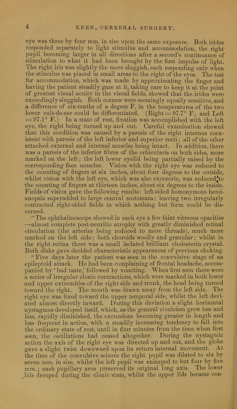 eye was three by four mm. in size upon the same exposure. Both irides responded separately to light stimulus and accommodation, the right pupil becoming larger in all directions after a second’s continuance of stimulation to what it had been brought by the first impulse of light. The right iris was slightly the more sluggish, each responding only when the stimulus was placed in small areas to the right of the eyes. The test for accommodation, which was made by approximating the finger and having the patient steadily gaze at it, taking care to keep it at the point of greatest visual acuity in the visual fields, showed that the irides were exceedingly sluggish. Both cornem were seemingly equally sensitive, and a difference of six-tenths of a degree F. in the temperatures of the two lower culs-de-sac could be differentiated. (Right = 97.7° F., and Left = 97.1° F.) In a state of rest, fixation was accomplished with the left eye, the right being turned up and out. Careful examination showed that this condition was caused by a paresis of the right internus coex- istent with paresis of the left inferior and superior recti; all of the other attached external and internal muscles being intact. In addition, there was a paresis of the inferior fibres of the orbicularis on both sides, more marked on the left; the left lower eyelid being partially raised by the corresponding face muscles. Vision with the right eye was reduced to the counting of fingers at six inches, about four degrees to the outside, whilst vision with the left eye, which was also excentric, was reducedjjto the counting of fingers at thirteen inches, about six degrees to the inside. Fields of vision gave the following results: left-sided homonymous hemi- anopsia superadded to large central scotomata; leaving two irregularly contracted right-sided fields in which nothing but form could be dis- cerned. “The ophthalmoscope showed in each eye a few faint vitreous opacities —almost complete post-neuritic atrophy with greatly diminished retinal circulation (the arteries being reduced to mere threads), much more marked on the left side; both choroids woolly and granular; whilst in the right retina there Avas a small isolated brilliant cholestei'in crystal. Both disks gave decided characteristic appearances of previous choking. “Five days later the patient was seen in the convulsive stage of an epileptoid attack. ITe had been complaining of frontal headache, accom- panied by 1 bad taste,’ folloAved by vomiting. When first seen there were a series of in-egular clonic contractions, which Avere marked in both loAATer and upper extremities of the right side and trunk, the head being turned toAvard the right. The mouth Avas draAvn aAvay from the left side. The right eye Avas fixed toward the upper temporal side, whilst the left devi- ated almost directly inward. During this deviation a slight horizontal nystagmus developed itself, Avhich, as the general clonicism greAV less and less, rapidly diminished, the excursions becoming greater in length and less frequent in action, with a steadily increasing tendency to fall into the ordinary state of rest, until in four minutes from the time Avhen first seen, the oscillations had ceased altogether. During the nystagmic action the axis of the right eye Avas directed up and out, and the globe gave a slight tAvist doAvnward upon its return internal movement. At the time of the convulsive seizure the right pupil Avas dilated to six by seven mm. in size, whilst the left pupil was enlarged to but four by five mm.; each pupillary area preserved its original long axis. The loAver lids drooped during the clonic state, whilst the upper lids became con-