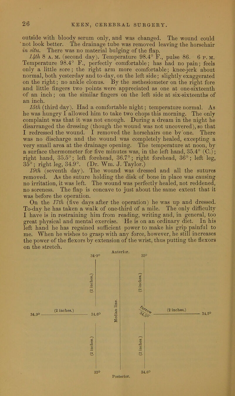 outside with bloody serum only, and was changed. The wound could not look better. The drainage tube was removed leaving the horsehair in situ. There was no material bulging of the flap. 11/ih 8 A. m. (second day). Temperature 98.4° F., pulse 86. 6 p. m. Temperature 98.4° F., perfectly comfortable; has had no pain; feels only a little sore; the right arm more comfortable; knee-jerk about normal, both yesterday and to-day, on the left side; slightly exaggerated on the right; no ankle clonus. By the sesthesiometer on the right fore and little fingers two points were appreciated as one at one-sixteenth of an inch ; on the similar fingers on the left side at six-sixteenths of an inch. 15tli (third day). Had a comfortable night; temperature normal. As he was hungry I allowed him to take two chops this morning. The only complaint was that it was not enough. During a dream in the night he disarranged the dressing (though the wound was not uncovered), so that I redressed the wound. I removed the horsehairs one by one. There was no discharge and the wound was completely healed, excepting a very small area at the drainage opening. The temperature at noon, by a surface thermometer for five minutes was, in the left hand, 35.4° (C.); right hand, 35.5°; left forehead, 36.7°; right forehead, 36° ; left leg, 35° ; right leg, 34.9°. (Dr. Win. J. Taylor.) 19th (seventh day). The wound was dressed and all the sutures removed. As the suture holding the disk of bone in place was causing no irritation, it was left. The wound was perfectly healed, not reddened, no soreness. The flap is concave to just about the same extent that it was before the operation. On the 17th (five days after the operation) he was up and dressed. To-day he has taken a walk of one-third of a mile. The only difficulty I have is in restraining him from reading, writing and, in general, too great physical and mental exercise. He is on an ordinary diet. In his left hand he has regained sufficient power to make his grip painful to me. When he wishes to grasp with any force, however, he still increases the power of the flexors by extension of the wrist, thus putting the flexors on the stretch. Anterior. 34-9° 35° 34.9° (2 inches.) — 34.6° (2 inches.) 34.5° 35° Posterior. 34.0°