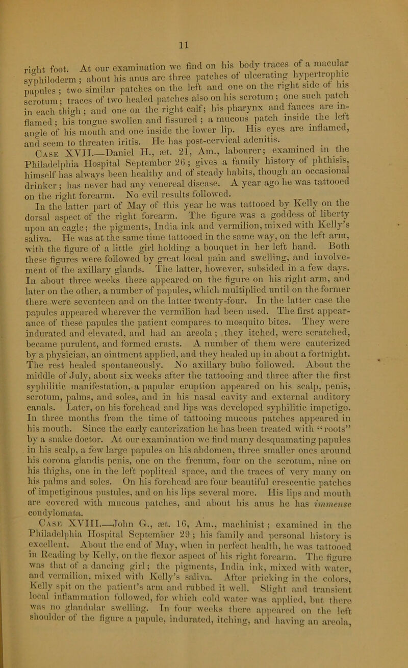 At our exam in ation we find on his body traces of a maculai flamed; his tongue swollen and fissured ; a mucous patch inside the lef t angle of his mouth and one inside the lower lip. His eyes are inflamed, and seem to threaten iritis. He has post-cervical adenitis. Case XVII Daniel H., set. 21, Am., labourer; examined m the Philadelphia Hospital September 2G ; gives a family history of phthisis, himself has always been healthy and of steady habits, though an occasional drinker ; has never had any venereal disease. A year ago he was tattooed on the right forearm. No evil results followed. In the latter part of May of this year he was tattooed by Kelly on the dorsal aspect of the right forearm. The figure was a goddess of liberty upon an eagle; the pigments, India ink and vermilion, mixed with Kelly’s saliva. He was at the same time tattooed in the same way, on the left arm, with the figure of a little girl holding a bouquet in her left hand. Both these figures were followed by great local pain and swelling, and involve- ment of the axillary glands. The latter, however, subsided in a few days. In about three weeks there appeared on the figure on his right arm, and later on the other, a number of papules, which multiplied until on the former there were seventeen and on the latter twenty-four. In the latter case the papules appeared wherever the vermilion had been used. The first appear- ance of these papules the patient compares to mosquito bites. They were indurated and elevated, and had an areola ; they itched, were scratched, became purulent, and formed crusts. A number of them were cauterized by a physician, an ointment applied, and they healed up in about a fortnight. The rest healed spontaneously. No axillary bubo followed. About the middle of July, about six weeks after the tattooing and three after the first syphilitic manifestation, a papular eruption appeared on his scalp, penis, scrotum, palms, and soles, and in his nasal cavity and external auditory canals. Later, on his forehead and lips was developed syphilitic impetigo. In three months from the time of tattooing mucous patches appeared in his mouth. Since the early cauterization he has been treated with “roots” by a snake doctor. At our examination we find many desquamating papules in his scalp, a few large papules on his abdomen, three smaller ones around his corona glandis penis, one on the frenum, four on the scrotum, nine on his thighs, one in the left popliteal space, and the traces of very many on his palms and soles. On his forehead are four beautiful crescentic patches of impetiginous pustules, and on his lips several more. His lips and mouth are covered with mucous patches, and about his anus he has immense condylomata. Case XVIII—John G., mt. 1G, Am., machinist; examined in the Philadelphia Hospital September 29 ; his family and personal history is excellent. About the end of May, when in perfect health, he was tattooed in Reading by Kelly, on the flexor aspect of his right forearm. The figure was that of a dancing girl; the pigments, India ink, mixed with water, and vermilion, mixed with Kelly’s saliva. After pricking in the colors, Kelly spit on the patient’s arm and rubbed it well. Slight and transient local inflammation followed, for which cold water was applied, but there was no glandular swelling. In four weeks there appeared on the left shoulder of the figure a papule, indurated, itching, and having an areola,