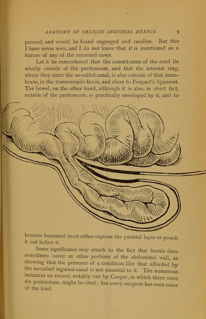pressed, and would be found engorged and swollen. But this I have never seen, and I do not know that it is mentioned as a feature of any of the recorded cases. Let it be remembered that the constituents of the cord lie wholly outside of the peritoneum, and that the internal ring, where they enter the so-called canal, is also outside of that mem- brane, in the transversalis fascia, and close to Poupart’s ligament. The bowel, on the other hand, although it is also, in strict fact, outside of the peritoneum, is practically enveloped by it, and to become herniated must either rupture the parietal layer or pouch it out before it. Some significance may attach to the fact that hernia does sometimes occur at other portions of the abdominal wall, as showing that the presence of a condition like that afforded' by the so-called inguinal canal is not essential to it. The numerous instances on record, notably one by Cooper, in which there were six protrusions, might be cited ; but every surgeon has seen cases of the kind.