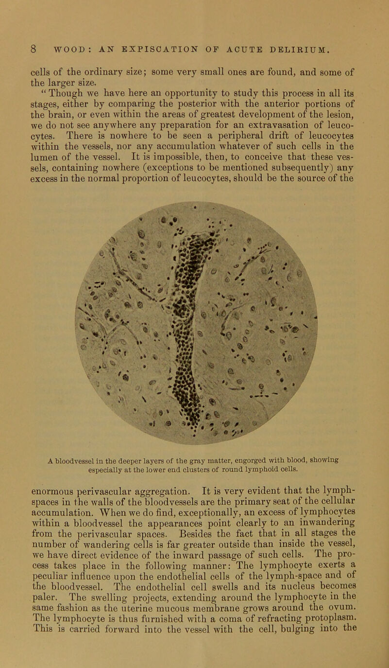 cells of the ordinary size; some very small ones are found, and some of the larger size. “ Though we have here an opportunity to study this process in all its stages, either by comparing the posterior with the anterior portions of the brain, or even within the areas of greatest development of the lesion, we do not see anywhere any preparation for an extravasation of leuco- cytes. There is nowhere to be seen a peripheral drift of leucocytes within the vessels, nor any accumulation whatever of such cells in the lumen of the vessel. It is impossible, then, to conceive that these ves- sels, containing nowhere (exceptions to be mentioned subsequently) any excess in the normal proportion of leucocytes, should be the source of the . V ° ' f ^ * r • A. » ° ' ^ s ■ if .. * '*/■* * *.V- \ \ * * X ' e 4* = V V v, ^ .. y ^ * t ■' “ * 4$.\ *V<* • 4 A bloodvessel in the deeper layers of the gray matter, engorged with blood, showing especially at the lower end clusters of round lymphoid cells. enormous perivascular aggregation. It is very evident that the lymph- spaces in the walls of the bloodvessels are the primary seat of the cellular accumulation. When we do find, exceptionally, an excess of lymphocytes within a bloodvessel the appearances point clearly to an inwandering from the perivascular spaces. Besides the fact that in all stages the number of wandering cells is far greater outside than inside the vessel, we have direct evidence of the inward passage of such cells. The pro- cess takes place in the following manner: The lymphocyte exerts a peculiar influence upon the endothelial cells of the lymph-space and of the bloodvessel. The endothelial cell swells and its nucleus becomes paler. The swelling projects, extending around the lymphocyte in the same fashion as the uterine mucous membraue grows around the ovum. The lymphocyte is thus furnished with a coma of refracting protoplasm. This is carried forward into the vessel with the cell, bulging into the