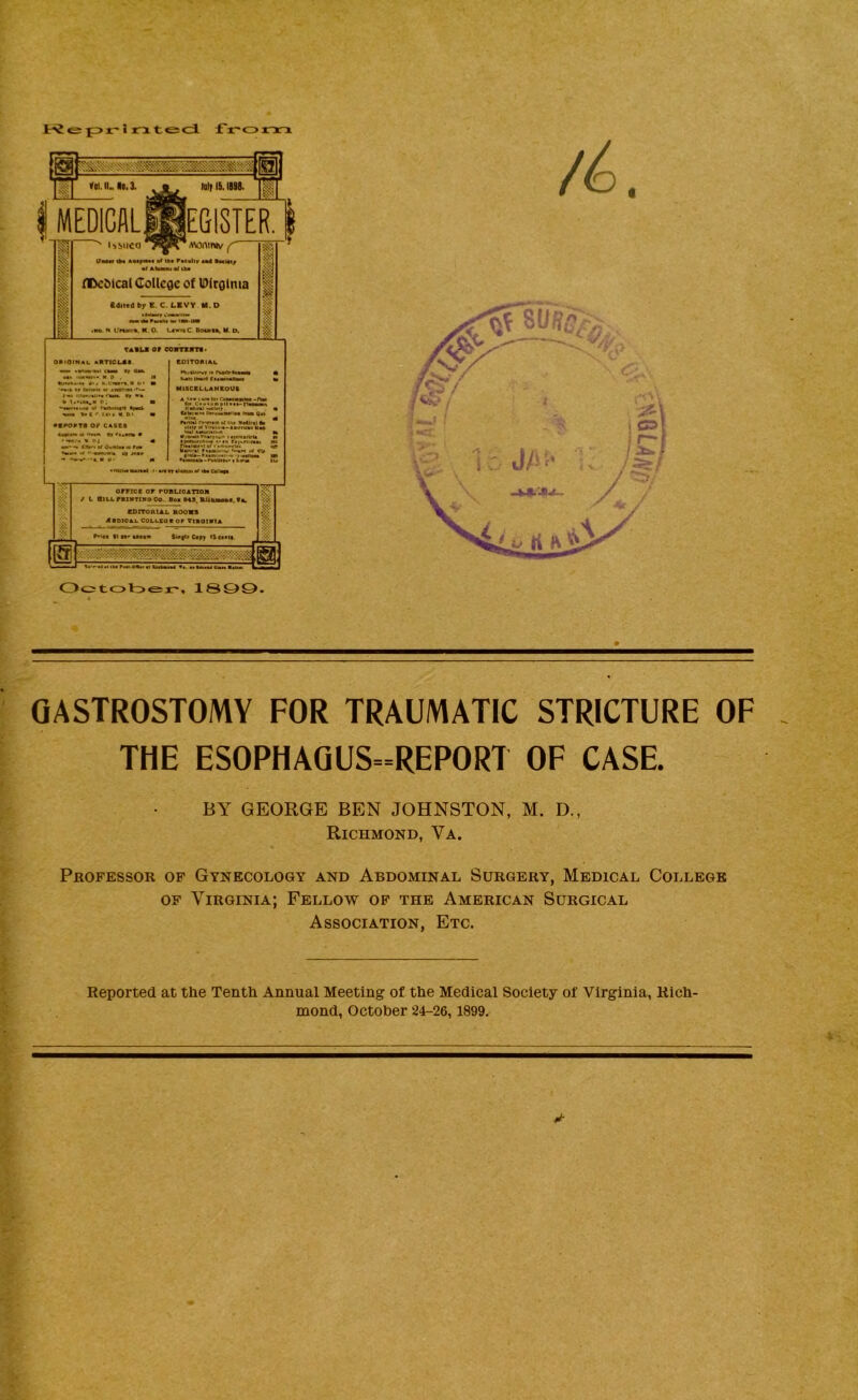 sntesci f'r'orTn 1 ^ 1 hit 16. Ilia. ht MEDICALHE&18TE R. I % 1 ^ i^sueo ■ wniNv ^ UM«r iPb A«»f MBA tl ipa F««wlir m4 •mim/ •1 APmahu «f tba rDcMcal Collcoc of Dirolnia Cdjicd by E. C. LBVY M.D ttaMarr w'lMSHHw AM Mb PwMf tm IMA IWi t«e. N UrtMi'A. M. 0. L«witC. Bouiik, M. D. I 1 •,SV tAtu or eorrsvTf* OmOINAL AKT10L«t. ftOlTOmAL •» **■ -.—T — T-~*~in'W • M p . n >gtt I»«i*f4 g«ww>ntm « 4*« (*• ■ MISCStCANtOUt * P. to p 1 rMkkWc* KMMl'MCMf. m m Cr^M>w c^ukMitM r>M Qm. • na />.««• fknui af 111* Mt4lril •• ' ***‘'« '■PI A Apa»M(r<i)i*i« \*«a ri|\ni<rut lei «■*••• csKt «r iS>iaM IB r»* w Wm ml ■•«MniU d* JC,, liBBioitu- of Wf w 0$ |—|- - | iiI1>m tB ** «' n *BNBMB-r«»IM»«* • IU> •nUMBartBl )• BfB«r 1 orrxcc or pobuoation / t SlLArRlNTIMOOe.- Box MS. &(«AttOAd.Vl. CDXTORtAL HOOm ASOlOAl. COLCSOB OP VllOIVlA P'MA Stn'uxa* SU|tr C*py iSeotu. iJ ««‘»-bAm<m Pm Q%ii At If A^wl «i. AA•baam 6«AM BaM Oc2tot>er, 1809. 4 « GASTROSTOMY FOR TRAUMATIC STRICTURE OF THE ESOPHAQUS==REPORT OF CASE. BY GEORGE BEN JOHNSTON, M. D., Richmond, Va. Professor of Gynecology and Abdominal Surgery, Medical College OF Virginia; Fellow of the American Surgical Association, Etc. Reported at the Tenth Annual Meeting of the Medical Society of Virginia, Rich-