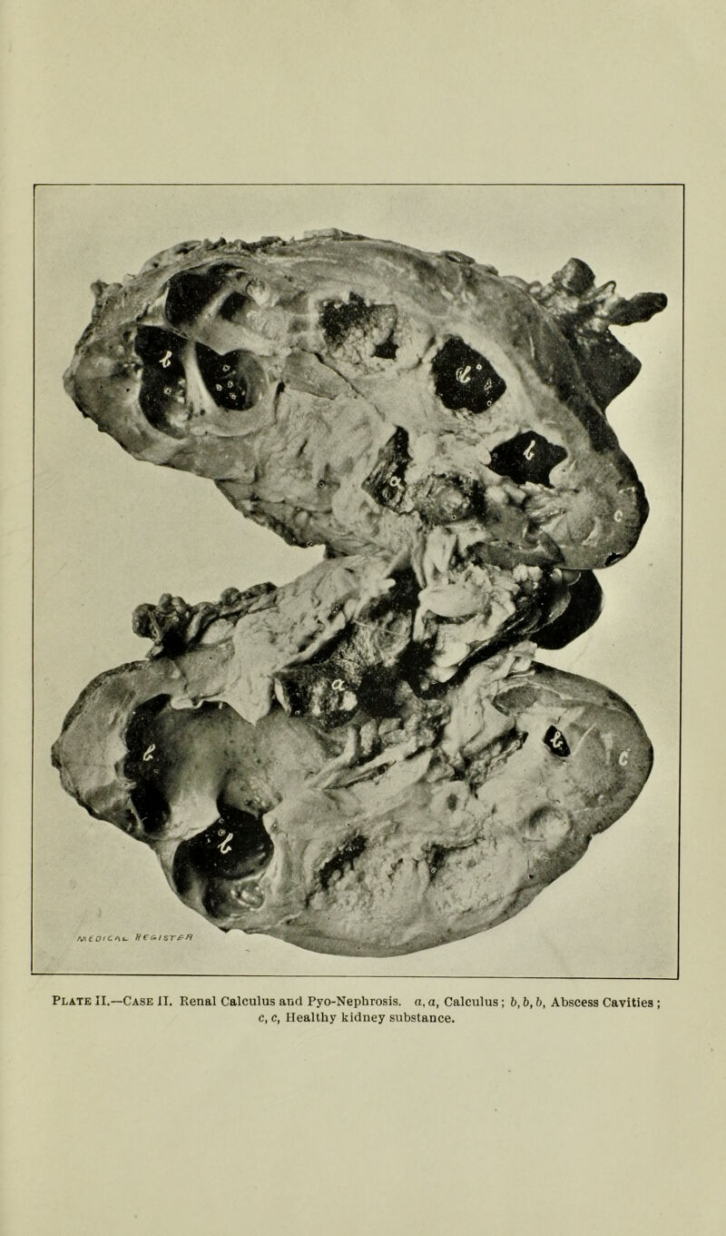 c, c, Healthy kidney substance.