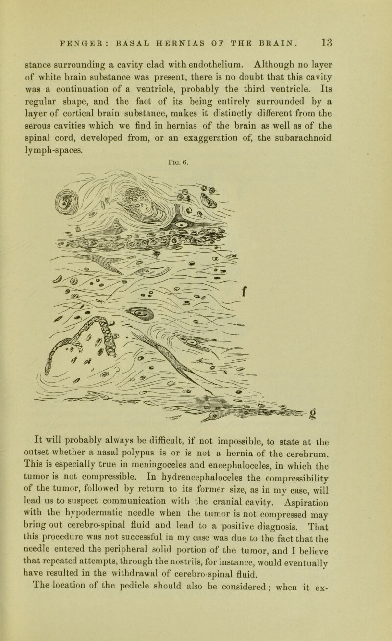 stance surrounding a cavity clad with endothelium. Although no layer of white brain substance was present, there is no doubt that this cavity was a continuation of a ventricle, probably the third ventricle. Its regular shape, and the fact of its being entirely surrounded by a layer of cortical brain substance, makes it distinctly different from the serous cavities which we find in hernias of the brain as well as of the spinal cord, developed from, or an exaggeration of, the subarachnoid lymph-spaces. Fig. 6. It will probably always be difficult, if not impossible, to state at the outset whether a nasal polypus is or is not a hernia of the cerebrum. This is especially true in meningoceles and encephaloceles, in which the tumor is not compressible. In hydrencephaloceles the compressibility of the tumor, followed by return to its former size, as in my case, will lead us to suspect communication with the cranial cavity. Aspiration with the hypodermatic needle when the tumor is not compressed may bring out cerebro-spinal fluid and lead to a positive diagnosis. That this procedure was not successful in my case was due to the fact that the needle entered the peripheral solid portion of the tumor, and I believe that repeated attempts, through the nostrils, for instance, would eventually have resulted in the withdrawal of cerebro-spinal fluid. The location of the pedicle should also be considered; when it ex-