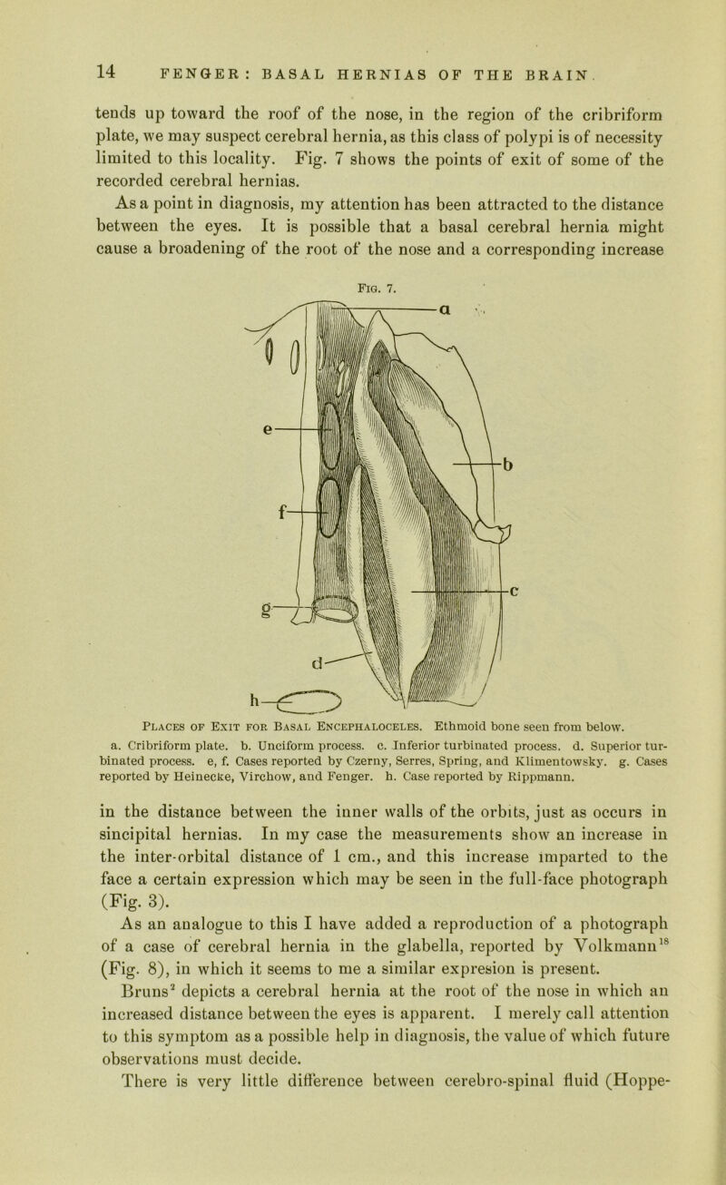 tends up toward the roof of the nose, in the region of the cribriform plate, we may suspect cerebral hernia, as this class of polypi is of necessity limited to this locality. Fig. 7 shows the points of exit of some of the recorded cerebral hernias. As a point in diagnosis, my attention has been attracted to the distance between the eyes. It is possible that a basal cerebral hernia might cause a broadening of the root of the nose and a corresponding increase Fig. 7. Places of Exit fop. Basal Encephaloceles. Ethmoid bone seen from below. a. Cribriform plate, b. Unciform process, c. Inferior turbinated process, d. Superior tur- binated process, e, f. Cases reported by Czerny, Serres, Spring, and Klimentowsky. g. Cases reported by Heinecke, Virchow, and Fenger. h. Case reported by Eippmann. in the distance between the inner walls of the orbits, just as occurs in sincipital hernias. In my case the measurements show an increase in the inter-orbital distance of 1 cm., and this increase imparted to the face a certain expression which may be seen in the full-face photograph (Fig. 3). As an analogue to this I have added a reproduction of a photograph of a case of cerebral hernia in the glabella, reported by Yolkmann18 (Fig. 8), in which it seems to me a similar expresion is present. Bruns2 depicts a cerebral hernia at the root of the nose in which an increased distance between the eyes is apparent. I merely call attention to this symptom as a possible help in diagnosis, the value of which future observations must decide. There is very little difference between cerebro-spinal fluid (Hoppe-