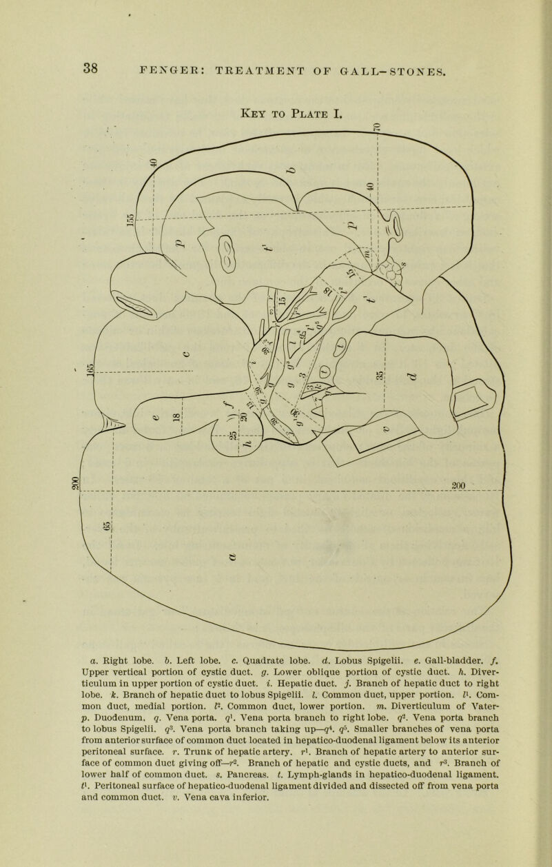 Key to Plate I. a. Right lobe. b. Left lobe. c. Quadrate lobe. cl. Lobus Spigelii. e. Gall-bladder. /. Upper vertical portion of cystic duct. g. Lower oblique portion of cystic duct. h. Diver- ticulum in upper portion of cystic duct. i. Hepatic duct. j. Branch of hepatic duct to right lobe. k. Branch of hepatic duct to lobus Spigelii. l. Common duct, upper portion. I1. Com- mon duct, medial portion. 1-. Common duct, lower portion, to. Diverticulum of Vater- p. Duodenum, q. Vena porta. q]. Vena porta branch to right lobe. q'2. Vena porta branch to lobus Spigelii. qs. Vena porta branch taking up—q4. q5. Smaller branches of vena porta from anterior surface of common duct located in hepatico-duodenal ligament below its anterior peritoneal surface, r. Trunk of hepatic artery, r1. Branch of hepatic artery to anterior sur- face of common duct giving off— r-. Branch of hepatic and cystic ducts, and r3. Branch of lower half of common duct. s. Pancreas, t. Lymph-glands in hepatico-duodenal ligament. f1. Peritoneal surface of hepatico-duodenal ligament divided and dissected off from vena porta and common duct. v. Vena cava inferior.