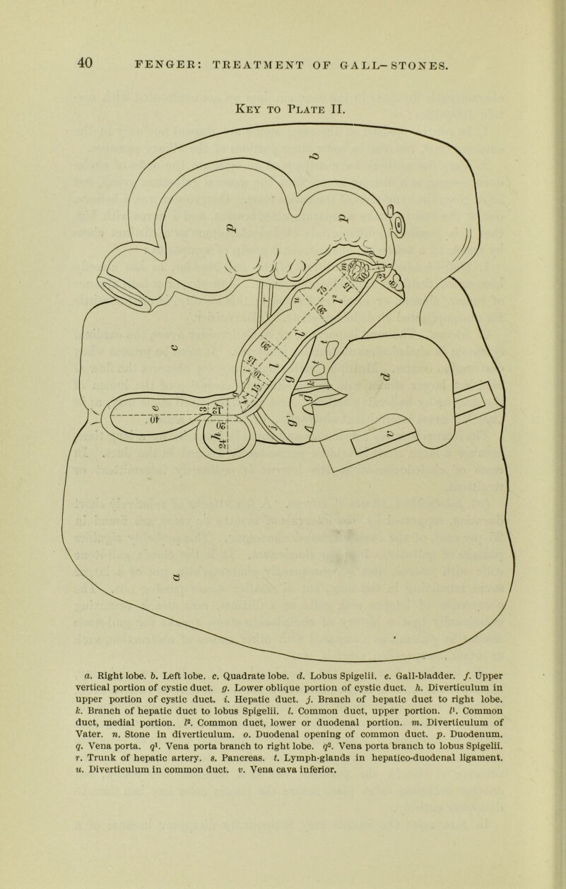 Key to Plate II. a. Right lobe. b. Left lobe. c. Quadrate lobe. d. Lobus Spigelii. e. Gall-bladder. /. Upper vertical portion of cystic duct. g. Lower oblique portion of cystic duct. h. Diverticulum in upper portion of cystic duct. i. Hepatic duct. j. Branch of hepatic duct to right lobe. k. Branch of hepatic duct to lobus Spigelii. 1. Common duct, upper portion. I1. Common duct, medial portion. 12. Common duct, lower or duodenal portion, in. Diverticulum of Vater. n. Stone in diverticulum, o. Duodenal opening of common duct. p. Duodenum. q. Vena porta. ql. Vena porta branch to right lobe, q2. Vena porta branch to lobus Spigelii. r. Trunk of hepatic artery, s. Pancreas, t. Lymph-glands in hepatico-duodenal ligament. u. Diverticulum in common duct. v. Vena cava inferior.