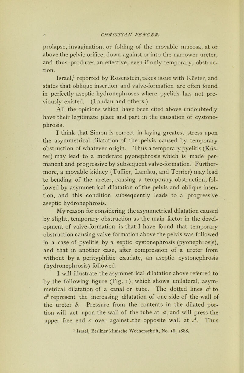 prolapse, invagination, or folding of the movable mucosa, at or above the pelvic orifice, down against or into the narrower ureter, and thus produces an effective, even if only temporary, obstruc- tion. Israel,^ reported by Rosenstein, takes issue with Kiister, and states that oblique insertion and valve-formation are often found in perfectly aseptic hydronephroses where pyelitis has not pre- viously existed. (Landau and others.) All the opinions which have been cited above undoubtedly have their legitimate place and part in the causation of cystone- phrosis. I think that Simon is correct in laying greatest stress upon the asymmetrical dilatation of the pelvis caused by temporary obstruction of whatever origin. Thus a temporary pyelitis (Kiis- ter) may lead to a moderate pyonephrosis which is made per- manent and progressive by subsequent valve-formation. Further- more, a movable kidney (Tuffier, Landau, and Terrier) may lead to bending of the ureter, causing a temporary obstruction, fol- lowed by asymmetrical dilatation of the pelvis and oblique inser- tion, and this condition subsequently leads to a progressive aseptic hydronephrosis. My reason for considering the asymmetrical dilatation caused by slight, temporary obstruction as the main factor in the devel- opment of valve-formation is that I have found that temporary obstruction causing valve-formation above the pelvis was followed in a case of pyelitis by a septic cystonephrosis (pyonephrosis), and that in another case, after compression of a ureter from without by a perityphlitic exudate, an aseptic cystonephrosis (hydronephrosis) followed. I will illustrate the asvmmetrical dilatation above referred to by the following figure (Fig. i), which shows unilateral, asym- metrical dilatation of a canal or tube. The dotted lines to represent the increasing dilatation of one side of the wall of the ureter b. Pressure from the contents in the dilated por- tion will act upon the wall of the tube at d, and will press the upper free end c over against .the opposite wall at d. Thus