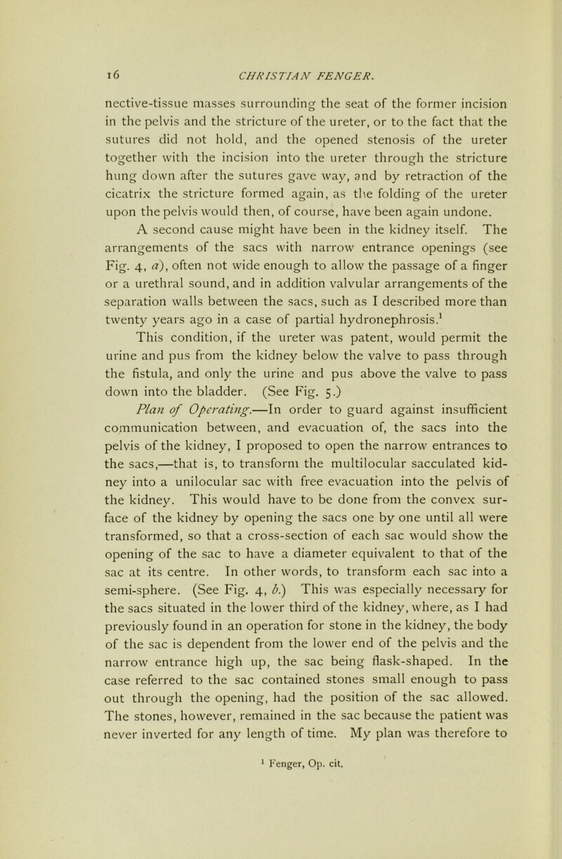 nective-tissLie masses surrounding the seat of the former incision in the pelvis and the stricture of the ureter, or to the fact that the sutures did not hold, and the opened stenosis of the ureter together with the incision into the ureter through the stricture hung down after the sutures gave way, and by retraction of the cicatrix the stricture formed again, as the folding of the ureter upon the pelvis would then, of course, have been again undone. A second cause might have been in the kidney itself. The arrangements of the sacs with narrow entrance openings (see Fig- 4. d), often not wide enough to allow the passage of a finger or a urethral sound, and in addition valvular arrangements of the separation walls between the sacs, such as I described more than twenty years ago in a case of partial hydronephrosisd This condition, if the ureter was patent, would permit the urine and pus from the kidney below the valve to pass through the fistula, and only the urine and pus above the valve to pass down into the bladder. (See Fig. 5.) Plan of Operating.—In order to guard against insufficient communication between, and evacuation of, the sacs into the pelvis of the kidney, I proposed to open the narrow entrances to the sacs,—that is, to transform the multilocular sacculated kid- ney into a unilocular sac with free evacuation into the pelvis of the kidney. This would have to be done from the convex sur- face of the kidney by opening the sacs one by one until all were transformed, so that a cross-section of each sac would show the opening of the sac to have a diameter equivalent to that of the sac at its centre. In other words, to transform each sac into a semi-sphere. (See Fig. 4, bi) This was especially necessary for the sacs situated in the lower third of the kidney, where, as I had previously found in an operation for stone in the kidney, the body of the sac is dependent from the lower end of the pelvis and the narrow entrance high up, the sac being flask-shaped. In the case referred to the sac contained stones small enough to pass out through the opening, had the position of the sac allowed. The stones, however, remained in the sac because the patient was never inverted for any length of time. My plan was therefore to ^ P^enger, Op. cit.