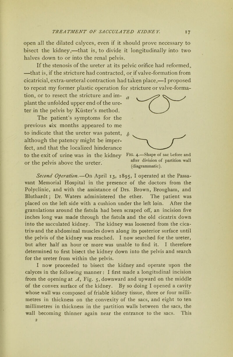 open all the dilated calyces, even if it should prove necessary to bisect the kidney,—that is, to divide it longitudinally into two halves down to or into the renal pelvis. If the stenosis of the ureter at its pelvic orifice had reformed,. —that is, if the stricture had contracted, or if valve-formation from cicatricial, extra-ureteral contraction had taken place,—I proposed to repeat my former plastic operation for stricture or valve-forma- tion, or to resect the stricture and im- plant the unfolded upper end of the ure- ter in the pelvis by Kuster’s method. The patient’s symptoms for the previous six months appeared to me to indicate that the ureter was patent, although the patency might be imper- fect, and that the localized hinderance to the exit of urine was in the kidney or the pelvis above the ureter. Second Operation.—On April 13, 1895, I operated at the Passa- vant Memorial Hospital in the presence of the doctors from the Polyclinic, and with the assistance of Drs. Brown, Brougham, and Bluthardt \ Dr. Waters administered the ether. The patient was placed on the left side with a cushion under the left loin. After the granulations around the fistula had been scraped off, an incision five inches long was made through the fistula and the old cicatrix down into the sacculated kidney. The kidney was loosened from the cica- trix* and the abdominal muscles down along its posterior surface until the pelvis of the kidney was reached. I now searched for the ureter, but after half an hour or more was unable to find it. I therefore determined to first bisect the kidney down into the pelvis and search for the ureter from within the pelvis. I now proceeded to bisect the kidney and operate upon the calyces in the following manner: I first made a longitudinal incision from the opening at A, Fig. 5, downward and upward on the middle of the convex surface of the kidney. By so doing I opened a cavity whose wall was composed of friable kidney tissue, three or four milli- metres in thickness on the convexity of the sacs, and eight to ten millimetres in thickness in the partition walls between the sacs, the wall becoming thinner again near the entrance to the sacs. This Fig. 4.—Shape of sac before and after division of partition wall (diagrammatic).