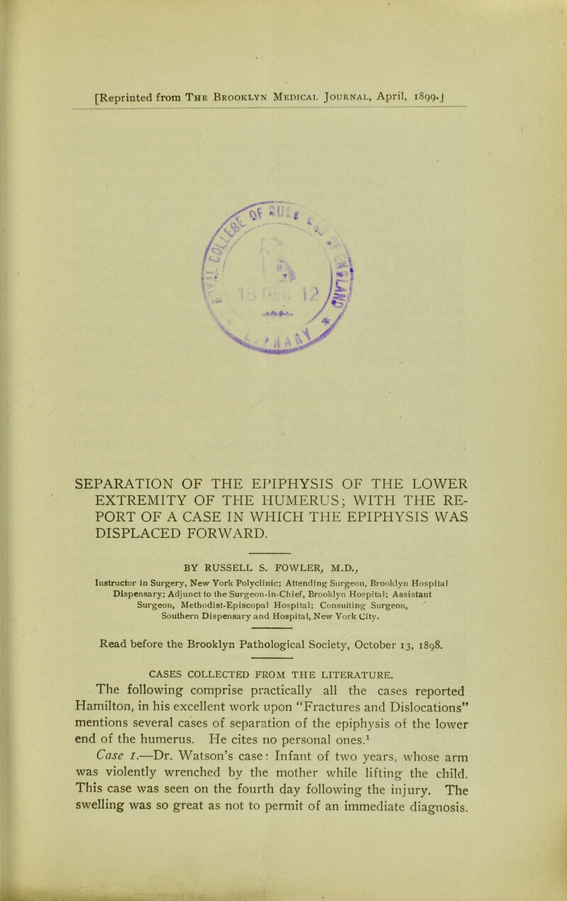 [Reprinted from The Brooklyn Medical Journal, April, 1899.J SEPARATION OF THE EPIPHYSIS OF THE LOWER EXTREMITY OF THE HUMERUS; WITH THE RE- PORT OF A CASE IN WHICH THE EPIPHYSIS WAS DISPLACED FORWARD. BY RUSSELL S. FOWLER, M.D., Instructor in Surgery, New York Polyclinic; Attending Surgeon, Brooklyn Hospital Dispensary; Adjunct to the Surgeon-in-Chief, Brooklyn Hospital; Assistant Surgeon, Methodist-Episcopal Hospital; Consulting Surgeon, Southern Dispensary and Hospital, New York City. Read before the Brooklyn Pathological Society, October 13, 1898. CASES COLLECTED FROM THE LITERATURE. The following comprise practically all the cases reported Hamilton, in his excellent work upon “Fractures and Dislocations’’ mentions several cases of separation of the epiphysis of the lower end of the humerus. He cites no personal ones.1 Case 1.—Dr. Watson’s case: Infant of two years, whose arm was violently wrenched by the mother while lifting the child. This case was seen on the fourth day following the injury. The swelling was so great as not to permit of an immediate diagnosis.