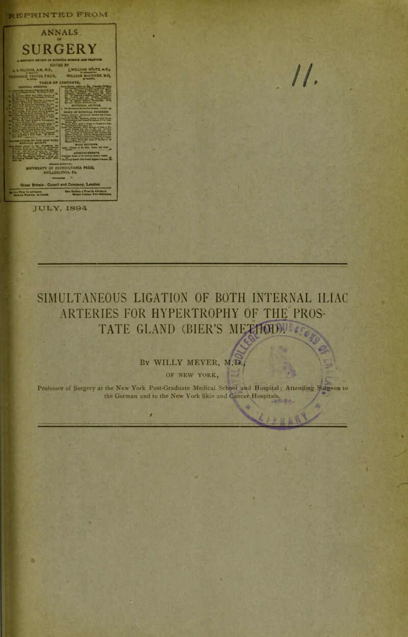 ^ef»rinte:d rrom ANNALS SURGERY • ••ifTK&.v um«r or vjwoKJkL mmKM turn nucnc* C01T£D »V t i. rilCHtR. A.K, M D, i.WILUAM wtlITt, H 0« FltOWtCK TKEVES.rites. WILLIAM MACEWgW, >U\ TAILS OP CONTENTS. Oremt firtttla: C«u«ll ond Comptny. London: ^e* • T«w la A«»asM. Om Oalata • T«a« to Ai«*aca teaau Omm. aaCaato> Oto«l* Ca»«M. Tw AtoUtoaa JUL.Y, 1804= SIMULTANEOUS LIGATION OF BOTH INTERNAL ILIAC ARTERIES FOR HYPERTROPHY OF THE'PROS- TATE GLAND (BIER’S Ml By willy MEYER, M.D./ OF NEW YORK, * t * • •** - f ^ i Professor of Surgery at the New York Post-Graduate Medical School and Hospital; Attending 9ii^«on to the German and to the New York Skin and Cancef' Hospitals. f ** '