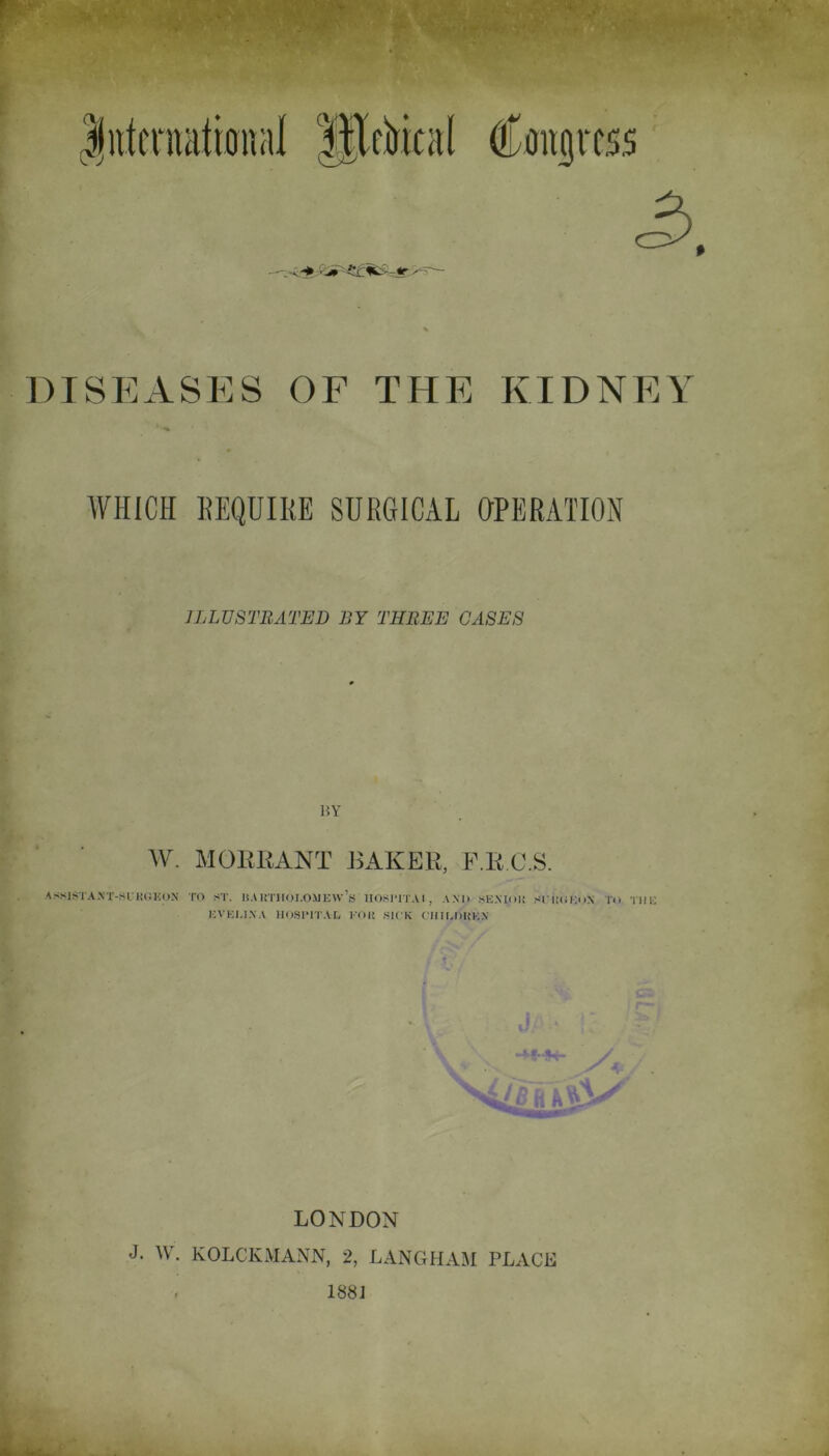 DISEASES OF THE KIDNEY WHICH REQUIRE SURGICAL OPERATION ILLUSTRATED BY THREE CASES BY W. MORRANT BAKER, F.R.C.S. AsslSTAN'X-SL'KGKON TO ST. HAUTHOf.OMKw’s IIOS1TTAI , AND SENIOR sIKGKoN To Till: KVKI.IXA HOSPITAL FOR .SICK CHILDREN i A / HK ', ;. Ik , « * L [\ \ V\ LONDON J. W. KOLCKMANN, 2, LANGHAM PLxVCE , 1881