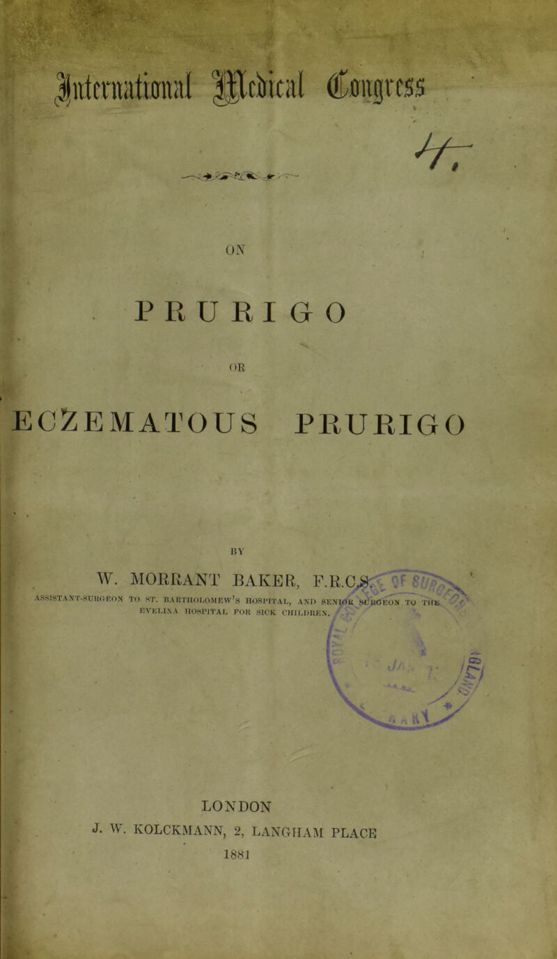 PRURIGO OR ECZEMATOUS PRURIGO m * - BY W. MORRANT BAKER, F.R.C.8. ASSISTANT-SURGEON TO ST. BARTHOLOMEW S HOSPITAL, AND SENIOR SCKOEON TO THE EVELINA HOSPITAL FOR SICK CHILDREN. LONDON J. W. IvOLCKMANN, 2, LANGHAM PLACE 1881