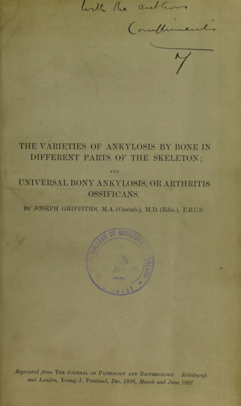 / THE VARIETIES OF ANKYLOSIS BY BONE IN DIFFERENT PARTS OF THE SKELETON; AND LTNIVERSAL BONY ANKYLOSIS, OR ARTHRITIS OSSIFICANS. By JOSEPH GRIFFITHS, M.A. (Cantab.), M.D. (Edin.), F.R.C.S. Reprinted from The Journal of Pathology and Bacteriology. Edintmrgh and London, Young J. Pentland, Dec. 1896, March and June 1897.