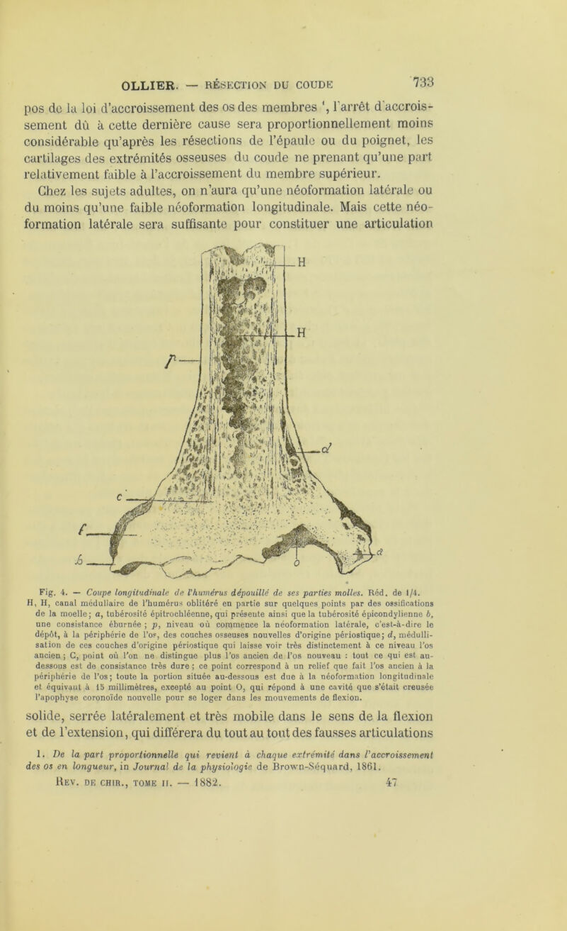 pos do la loi d’accroissement des os des membres ', l'arrêt d'accrois- sement dù à cette dernière cause sera proportionnellement moins considérable qu’après les résections de l’épaule ou du poignet, les cartilages des extrémités osseuses du coude ne prenant qu’une part relativement faible à l’accroissement du membre supérieur. Chez les sujets adultes, on n’aura qu’une néoformation latérale ou du moins qu’une faible néoformation longitudinale. Mais cette néo- formation latérale sera suffisante pour constituer une articulation Fig. 4. — Coupe longitudinale de l’humérus dépouillé de ses parties molles. Réd. de 1/4. H, H, canal médullaire de l’humérus oblitéré en partie sur quelques points par des ossifications de la moelle; a, tubérosité épitrochléenne, qui présente ainsi que la tubérosité épicondylienne b, une consistance éburnée ; p, niveau où commence la néoformation latérale, c’est-à-dire le dépôt, à la périphérie de l’os, des couches osseuses nouvelles d’origine périostique; d, médulli- sation de ces couches d’origine périostique qui laisse voir très distinctement à ce niveau l’os ancien ; C, point où l’on ne distingue plus l’os ancien de l’os nouveau : tout ce qui est au- dessous est de consistance très dure ; ce point correspond à un relief que fait l’os ancien à la périphérie de l’os; toute la portion située au-dessous est due à la néoformation longitudinale et équivaut à 15 millimètres, excepté au point O, qui répond à une cavité que s’était creusée l’apophyse coronoïde nouvelle pour se loger dans les mouvements de flexion. solide, serrée latéralement et très mobile dans le sens de la flexion et de l’extension, qui différera du tout au tout des fausses articulations 1. De la part proportionnelle qui revient à chaque extrémité dans l’accroissement des os en longueur, in Journal de la physiologie de Brown-Séquard, 1861. Rev. de chir., tome ir. — 1882. 47