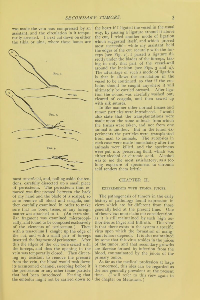 was made the vein was compressed by an assistant, and the circulation in it tempo- rarily arrested. I next cut down on either the tibia or ulna, where these bones are the heart if I ligated the vessel in the usual way, by passing a ligature around it above the cut, I tried another mode of ligation which suggested itself, and which proved most successful: while my assistant held the edges of the cut securely with the for- ceps (see Fig. 2). I passed a ligature di- rectly under the blades of the forceps, tak- ing in only that part of the vessel-wall around the incision (see Figs. 3 and 4). The advantage of such a mode of ligation is that it allows the circulation in the vessel to be continued, so that if the em- bolus should be caught anywhere it will ultimately be carried onward. After liga- tion the wound was carefully washed out, cleared of coagula, and then sewed up with silk sutures. In like manner other normal tissues and tumor particles were introduced. I would also state that the transplantations were made upon the same animals from which the tissues were taken, and not from one animal to another. But in the tumor ex- periments the particles were transplanted from man to animals. The autopsies in each case were made immediately after the animals were killed, and the specimens were put into preserving fluid, which was either alcohol or chromic acid. Alcohol was to me the most satisfactory, as a too long exposure of specimens to chromic acid renders them brittle. most superficial, and, pulling aside the ten- dons, carefully dissected up a small piece of periosteum. The periosteum thus re- moved was first pressed between the back of my hand and the blade of a scalpel, so as to remove all blood and coagula, and then carefully examined in order to make sure that no bone, tissue, or any foreign matter was attached to it. (An extra sim- ilar fragment was examined microscopi- cally, and found to be composed exclusively of the elements of periosteum.) Then with a tenaculum I caught up the edge of the cut, and with a small pair of forceps inserted the fragment of periosteum. After this the edges of the cut were seized with the forceps, and thus the opening in the vein was temporarily closed. Then direct- ing my assistant to remove the pressure from the vein, the blood would rush down its accustomed channel, sweeping before it the periosteum or any other tissue particle that had been introduced. Fearing that the embolus might not be carried down to CHAPTER II. EXPERIMENTS WITH TUMOR JUICES. The pathogenesis of tumors in the early history of pathology found expression in views which are far different from those generally held at the present time. One of these views must claim our consideration, as it is still maintained by such high au- thorities as Paget and Billroth. This view is that there exists in the system a specific virus upon which the formation of malig- nant tumors depends. It is also maintained by some that this virus resides in the juices of the tumor, and that secondary growths are likewise formed by infection from the blood, contaminated by the juices of the primary tumor. As far as the medical profession at large is concerned, this idea can be regarded as the one generally prevalent at the present time. (I will refer to this view again in the chapter on Metastasis.)