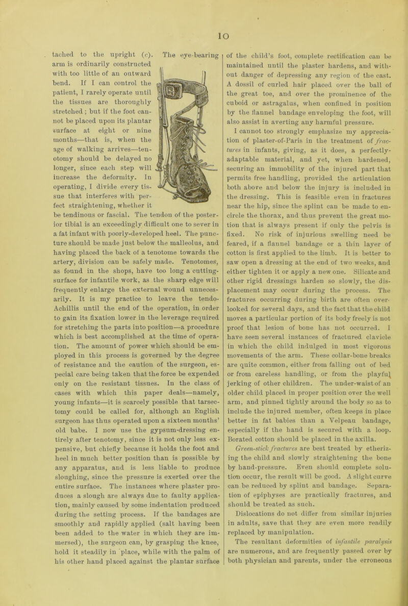 taclied to the upright (c). The eye-bearing arm is ordinarily constructed with too little of an outward bend. If I can control the patient, I rarely operate until the tissues are thoroughly stretched ; but if the foot can- not be placed upon its plantar surface at eight or nine months—that is, when the age of walking arrives—ten- otomy should be delayed no longer, since each step will increase the deformity. In operating, I divide every tis- sue that interferes with per- fect straightening, whether it be tendinous or fascial. The tendon of the poster- ior tibial is an exceedingly difficult one to sever in a fat infant with poorly-developed heel. The punc- ture should be made just below the malleolus, and having placed the back of a tenotome towards the artery, division can be safely made. Tenotomes, as found in the shops, have too long a cutting- surface for infantile work, as the sharp edge will frequently enlarge the external wound unneces- arily. It is my practice to leave the tendo- Achillis until the end of the operation, in order to gain its fixation lower in the leverage required for stretching the parts into position—a procedure which is best accomplished at the time of opera- tion. The amount of power which should be em- ployed in this process is governed by the degree of resistance and the caution of the surgeon, es- pecial care being taken that the force be expended only on the resistant tissues. In the class of cases with which this paper deals—namely, young infants—it is scarcely possible that tarsec- tomy could be called for, although an English surgeon has thus operated upon a sixteen months’ old babe. I now use the gypsum-dressing en- tirely after tenotomy, since it is not only less ex- pensive, but chiefly becairse it holds the foot and heel in much better position than is possible by any apparatus, and is less liable to produce sloughing, since the pressure is exerted over the entire surface. The instances where plaster pro- duces a slough are always due to faulty applica- tion, mainly caused by some indentation produced during the setting process. If the bandages are smoothly and rapidly applied (salt having been been added to the water in which they are im- mersed), the surgeon can, by grasping the knee, hold it steadily in place, while with the palm of his other hand placed against the plantar surface of the child’s foot, complete rectification can be maintained until the plaster hardens, and with- out danger of depressing any region of the cast. A dossil of curled hair placed over the ball of the great toe, and over the prominence of the cuboid or astragalus, when confined in position by the flannel bandage enveloping the foot, will also assist in averting any harmful pressure. I cannot too strongly emphasize my apprecia- tion of plaster-of-Paris in the treatment oi frac- tures in infants, giving, as it does, a perfectly- adaptable material, and yet, when hardened, securing an immobility of the injured part that permits free handling, provided the articulation both above and below the injury is included in the dressing. This is feasible even in fractures near the hip, since the splint can be made to en- circle the thorax, and thus prevent the great mo- tion that is always present if only the pelvis is fixed. No risk of injurious swelling need be feared, if a flannel bandage or a thin layer of cotton is first applied to the limb. It is better to saw open a dressing at the end of two weeks, and either tighten it or apply a new one. Silicate and other rigid dressings harden so slowly, the dis- placement may occur during the process. The fractures occurring during birth are often over- looked for several days, and the fact that the child moves a particular portion of its body freely is not proof that lesion of bone has not occurred. I have seen several instances of fractured clavicle in which the child indulged in most vigorous movements of the arm. These collar-bone breaks are quite common, either from falling out of bed or from careless handling, or from the playfu^ jerking of other children. The under-waist of an older child placed in proper position over the well arm, and pinned tightly around the body so as to include the injured member, often keeps in place better in fat babies than a Velpeau bandage, especially if the hand is secured with a loop. Borated cotton should be placed in the axilla. Green-stick fractures are best treated by etheriz- ing the child and slowly straightening the bone by hand-pressure. Even should complete solu- tion occur, the result will be good. A slight curve can be reduced by splint and bandage. Separa- tion of epiphyses are practically fractures, and should be treated as such. Dislocations do not differ from similar injuries in adults, save that they are even more readily replaced by manipulation. The resultant deformities of infantile paralysis are numerous, and are frequently passed over by both physician and parents, under the erroneous
