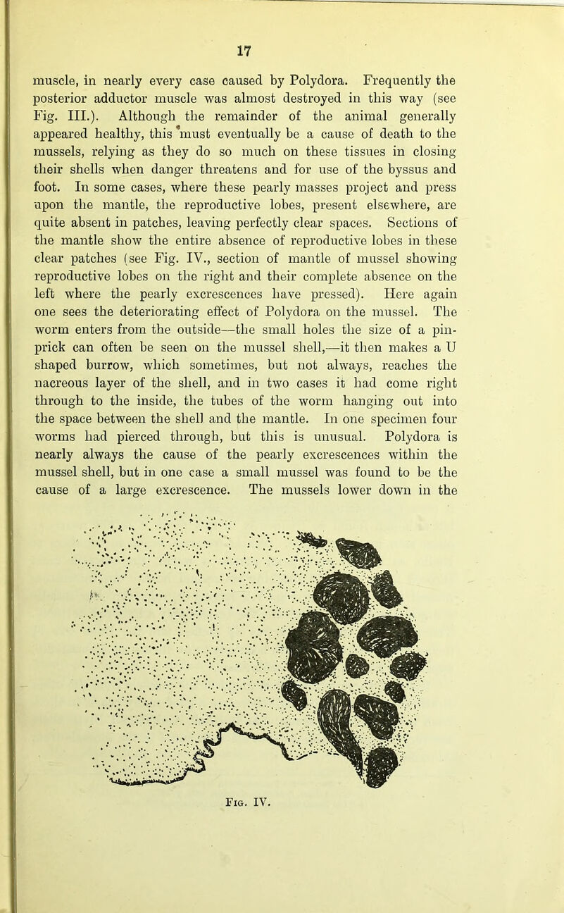 muscle, in nearly every case caused by Polydora. Frequently the posterior adductor muscle was almost destroyed in this way (see Fig. III.). Although the remainder of the animal generally appeared healthy, this must eventually be a cause of death to the mussels, relying as they do so much on these tissues in closing their shells when danger threatens and for use of the byssus and foot. In some cases, where these pearly masses project and press upon the mantle, the reproductive lobes, present elsewhere, are quite absent in patches, leaving perfectly clear spaces. Sections of the mantle show the entire absence of reproductive lobes in these clear patches (see Fig. IV., section of mantle of mussel showing- reproductive lobes on the right and their complete absence on the left where the pearly excrescences have pressed). Here again one sees the deteriorating effect of Polydora on the mussel. The worm enters from the outside—the small holes the size of a pin- prick can often be seen on the mussel shell,—it then makes a U shaped burrow, which sometimes, but not always, reaches the nacreous layer of the shell, and in two cases it had come right through to the inside, the tubes of the worm hanging out into the space between the shell and the mantle. In one specimen four worms had pierced through, but this is unusual. Polydora is nearly always the cause of the pearly excrescences within the mussel shell, but in one case a small mussel was found to be the cause of a large excrescence. The mussels lower down in the