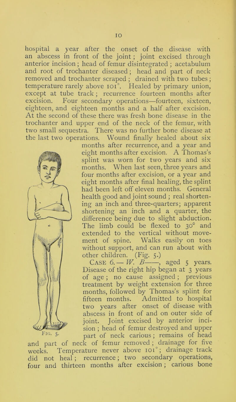 IO hospital a year after the onset of the disease with an abscess in front of the joint ; joint excised through anterior incision ; head of femur disintegrated ; acetabulum and root of trochanter diseased; head and part of neck removed and trochanter scraped ; drained with two tubes; temperature rarely above ioi°. Healed by primary union, except at tube track ; recurrence fourteen months after excision. Four secondary operations—fourteen, sixteen, eighteen, and eighteen months and a half after excision. At the second of these there was fresh bone disease in the trochanter and upper end of the neck of the femur, with two small sequestra. There was no further bone disease at the last two operations. Wound finally healed about six months after recurrence, and a year and eight months after excision. A Thomas’s splint was worn for two years and six months. When last seen, three years and four months after excision, or a year and eight months after final healing, the splint had been left off eleven months. General health good and joint sound ; real shorten- ing an inch and three-quarters; apparent shortening an inch and a quarter, the difference being due to slight abduction. The limb could be flexed to 30° and extended to the vertical without move- ment of spine. Walks easily on toes without support, and can run about with other children. (Fig. 5.) Case 6.— IV. B , aged 5 years. Disease of the right hip began at 3 years of age ; no cause assigned; previous treatment by weight extension for three months, followed by Thomas’s splint for fifteen months. Admitted to hospital two years after onset of disease with abscess in front of and on outer side of joint. Joint excised by anterior inci- sion ; head of femur destroyed and upper part of neck carious; remains of head and part of neck of femur removed ; drainage for five weeks. Temperature never above ioi0; drainage track did not heal ; recurrence; two secondary operations, four and thirteen months after excision ; carious bone