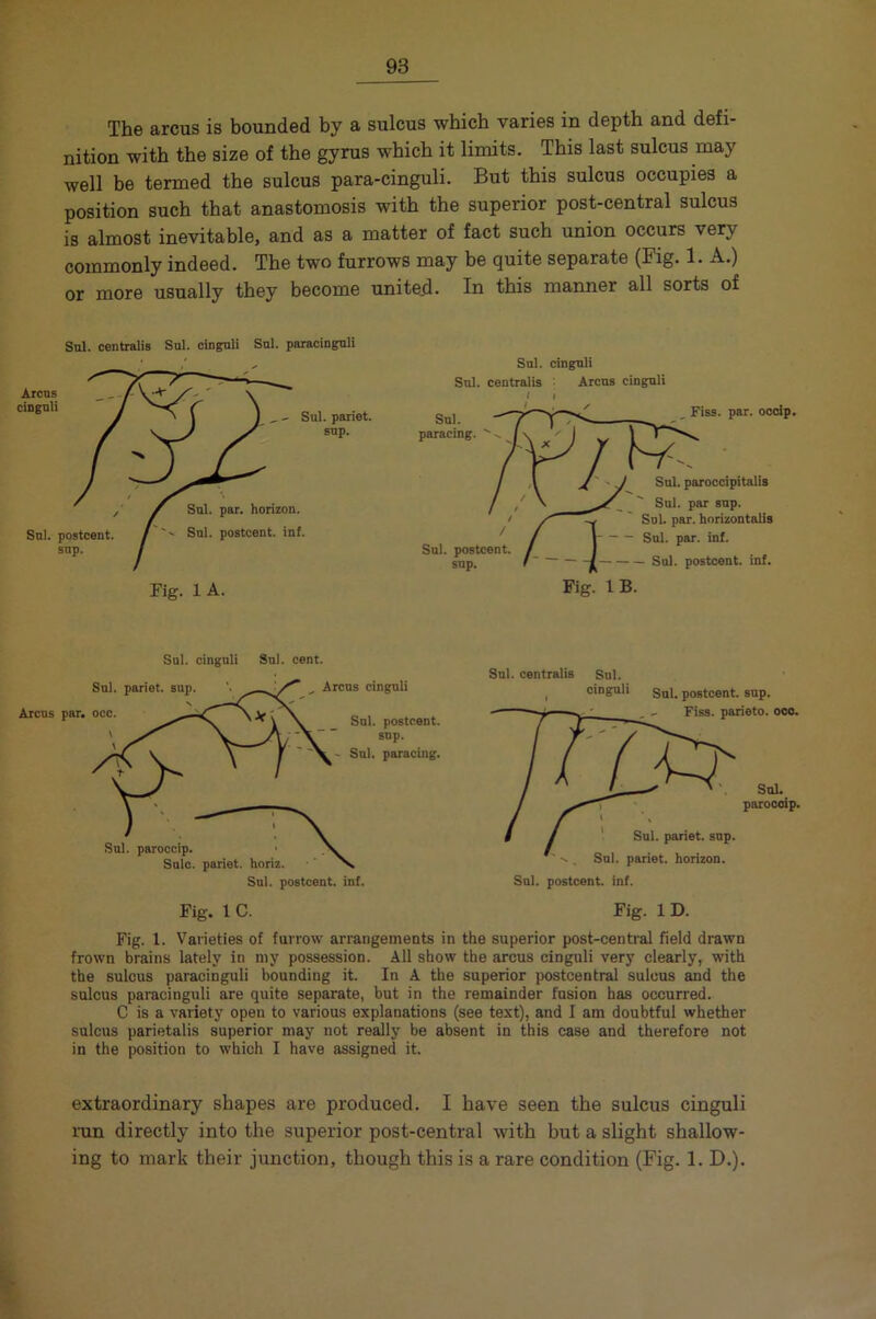 The arcus is bounded by a sulcus which varies in depth and defi- nition with the size of the gyrus which it limits. This last sulcus may well be termed the sulcus para-cinguli. But this sulcus occupies a position such that anastomosis with the superior post-central sulcus is almost inevitable, and as a matter of fact such union occurs very commonly indeed. The two furrows may be quite separate (Fig. 1. A.) or more usually they become united. In this manner all sorts of Sul. centralis Sul. cinguli Sul. paracinguli Sul. cinguli Sul. centralis Arcus cinguli Sul. paracing. _ Fiss. par. occip. Sul. postcent. J sup. Sul. paroccipitalis Sul. par sup. Sul. par. horizontalis Sul. par. inf. Sul. postcent. inf. Fig. 1 B. Sul. cinguli Sul. cent. Sul. pariet. sup. '. ^, Arcus cinguli Arcus par. occ Sul. postcent. sup. Sul. paracing. Sul. paroccip. • Sole, pariet. horiz. Sul. postcent. inf. Sul. centralis Sul. cinguli Sul. postcent. sup. Fiss. parieto. occ. Sul. paroccip. Sul. pariet. sup. Sul. pariet. horizon. Sul. postcent. inf. Fig. 1 C. Fig. 1 D. Fig. 1. Varieties of furrow arrangements in the superior post-central field drawn frown brains lately in my possession. All show the arcus cinguli very clearly, with the sulcus paracinguli bounding it. In A the superior postcentral sulcus and the sulcus paracinguli are quite separate, but in the remainder fusion has occurred. C is a variety open to various explanations (see text), and I am doubtful whether sulcus parietalis superior may not really be absent in this case and therefore not in the position to which I have assigned it. extraordinary shapes are produced. I have seen the sulcus cinguli run directly into the superior post-central with but a slight shallow- ing to mark their junction, though this is a rare condition (Fig. 1. D.).