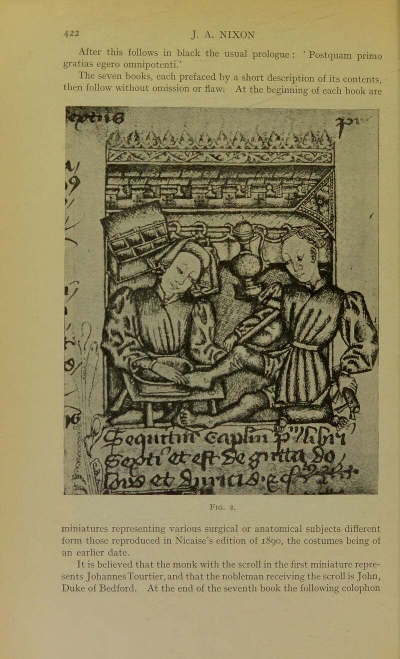 After this follows in black the usual prologue ' Postcjuam primo gratias egero omnipotenti.’ The seven books, each prefaced by a short description of its contents, then follow without omission or flaw. At the beginning of each book are Fig. 2. miniatures representing v^arious surgical or anatomical subjects different form those reproduced in Nicaise’s edition of 1890, the costumes being of an earlier date. It is believ'ed that tlie monk with the scroll in the first miniature repre- sents JohannesTourtier, and that the nobleman receiving the scroll is John, Duke of Bedford. At the end of the sev^enth book the following colophon