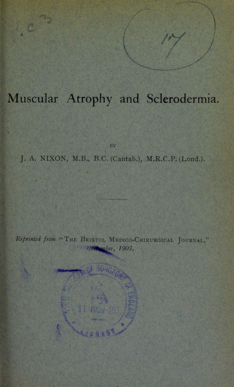 Muscular Atrophy and Sclerodermia. BY J. A. NIXON, M.B., B.C. (Cantab.), M.R.C.P. (Lond.). Reprinted from “The Bristol Medico-Chirurgical Journal,” 1903.