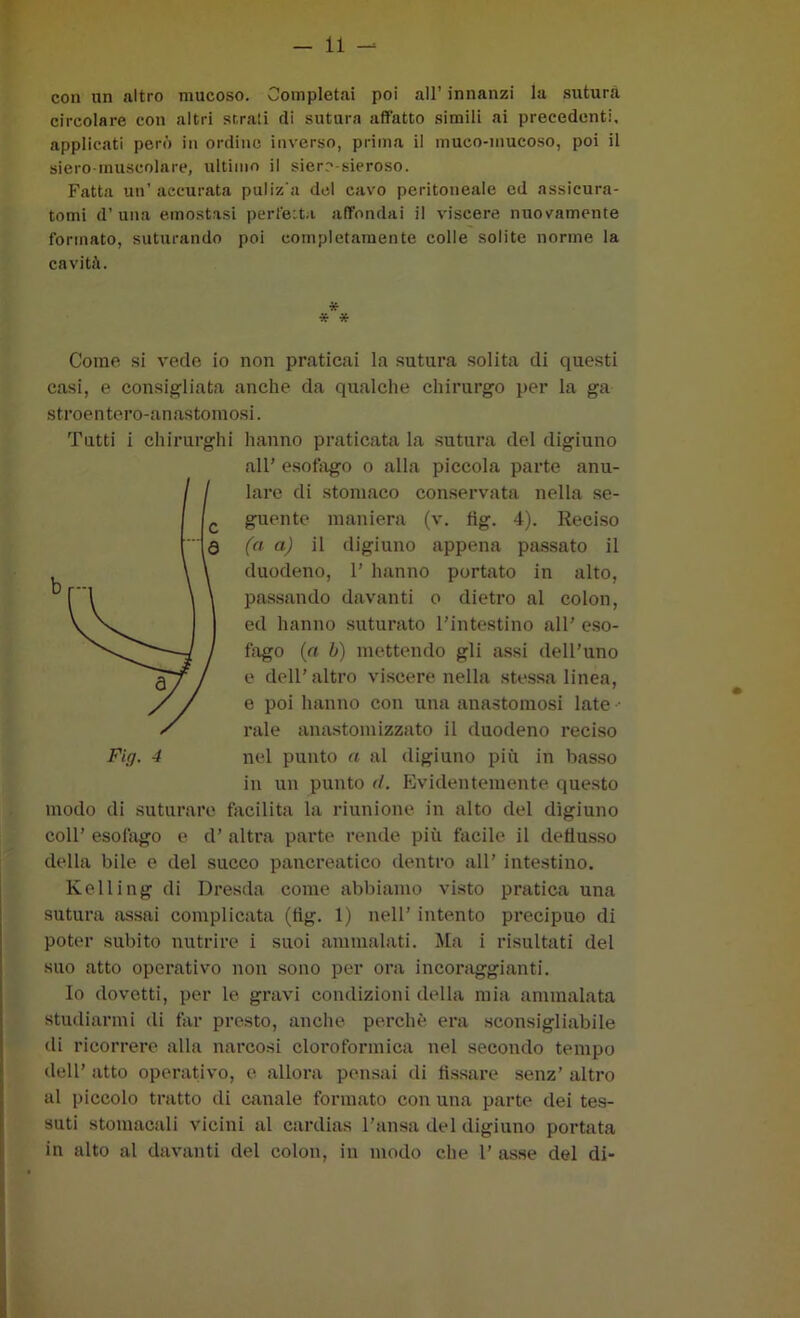 con un altro mucoso. Completai poi all’ innanzi la sutura circolare con altri sr.rati di sutura affatto simili ai precedenti, applicati però in ordino inverso, prima il muco-mucoso, poi il siero-muscolare, ultimo il siero-sieroso. Fatta un’ accurata puliz a del cavo peritoneale ed assicura- tomi d’ una emostasi perfetta affondai il viscere nuovamente formato, suturando poi completamente colle solite norme la cavità. * * * Come si vede io non praticai la sutura solita di questi casi, e consigliata anche da qualche chirurgo per la ga stroentero-anastomosi. Tutti i chirurghi hanno praticata la sutura del digiuno all’ esofago o alla piccola parte anu- lare di stomaco conservata nella se- guente maniera (v. fig. 4). Reciso fa aj il digiuno appena passato il duodeno, 1’ hanno portato in alto, passando davanti o dietro al colon, ed hanno suturato l’intestino all’ eso- fiigo (a b) mettendo gli assi dell’uno e dell’ altro viscere nella .stessa linea, e poi Iianno con una anastomosi late -• rale anastomizzato il duodeno reciso nel punto a al digiuno più in basso in un punto </. Evidentemente questo modo di suturare facilita la riunione in alto del digiuno coll’ esofago e d’ altra parte rende più facile il deflusso della bile e del succo pancreatico dentro all’ intestino. Kelling di Dresda come abbiamo visto pratica una sutura assai complicata (flg. 1) nell’ intento precipuo di poter subito nutrire i suoi ammalati. Ma i risultati del suo atto operativo non sono per ora incoraggianti. Io dovetti, per le gravi condizioni della mia ammalata studiarmi di far presto, anche perchè era sconsigliabile di ricorrere alla narcosi cloroformica nel secondo tempo dell’ atto operativo, e allora pensai di fl.ssare senz’ altro al piccolo tratto di canale formato con una parte dei tes- suti stomacali vicini al cardias l’ansa del digiuno portata in alto al davanti del colon, in modo che 1’ asse del di-