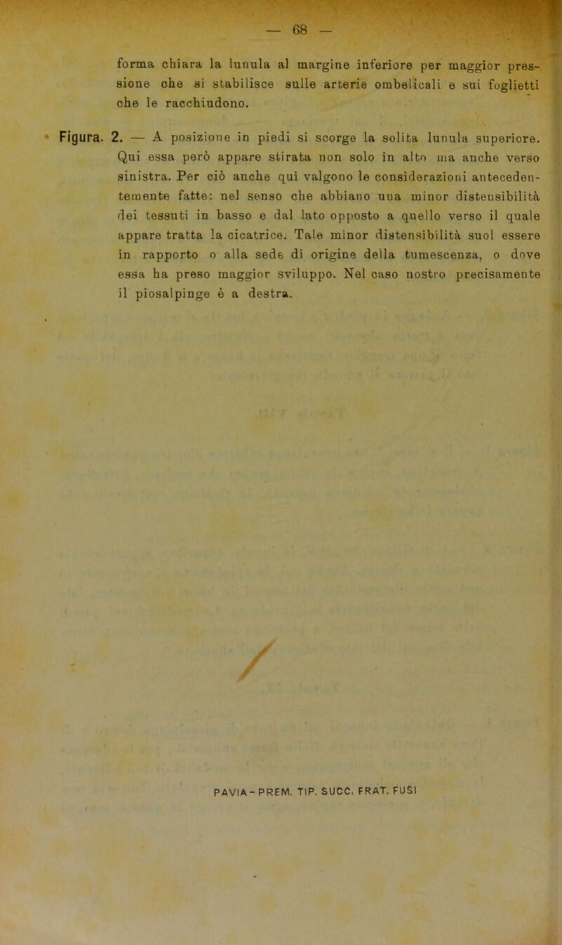 forma chiara la lunula al margine inferiore per maggior pres- sione ohe si stabilisce sulle arterie ombelicali e sui foglietti che le racchiudono. Figura. 2. — A posizione in piedi si scorge la solita lunula superiore. Qui essa però appare stirata non solo in alto ma anche verso sinistra. Per ciò anche qui valgono le considerazioni anteceden- temente fatte: nel senso che abbiano uua minor distensibilità dei tessuti in basso e dal lato opposto a quello verso il quale appare tratta la cicatrice. Tale minor distensibilità suol essere in rapporto o alla sede di origine della tumescenza, o dove essa ha preso maggior sviluppo. Nel caso nostro precisamente il piosalpinge è a destra. PAVIA- PREM. TIP. SUCC, FRAT. FUSI