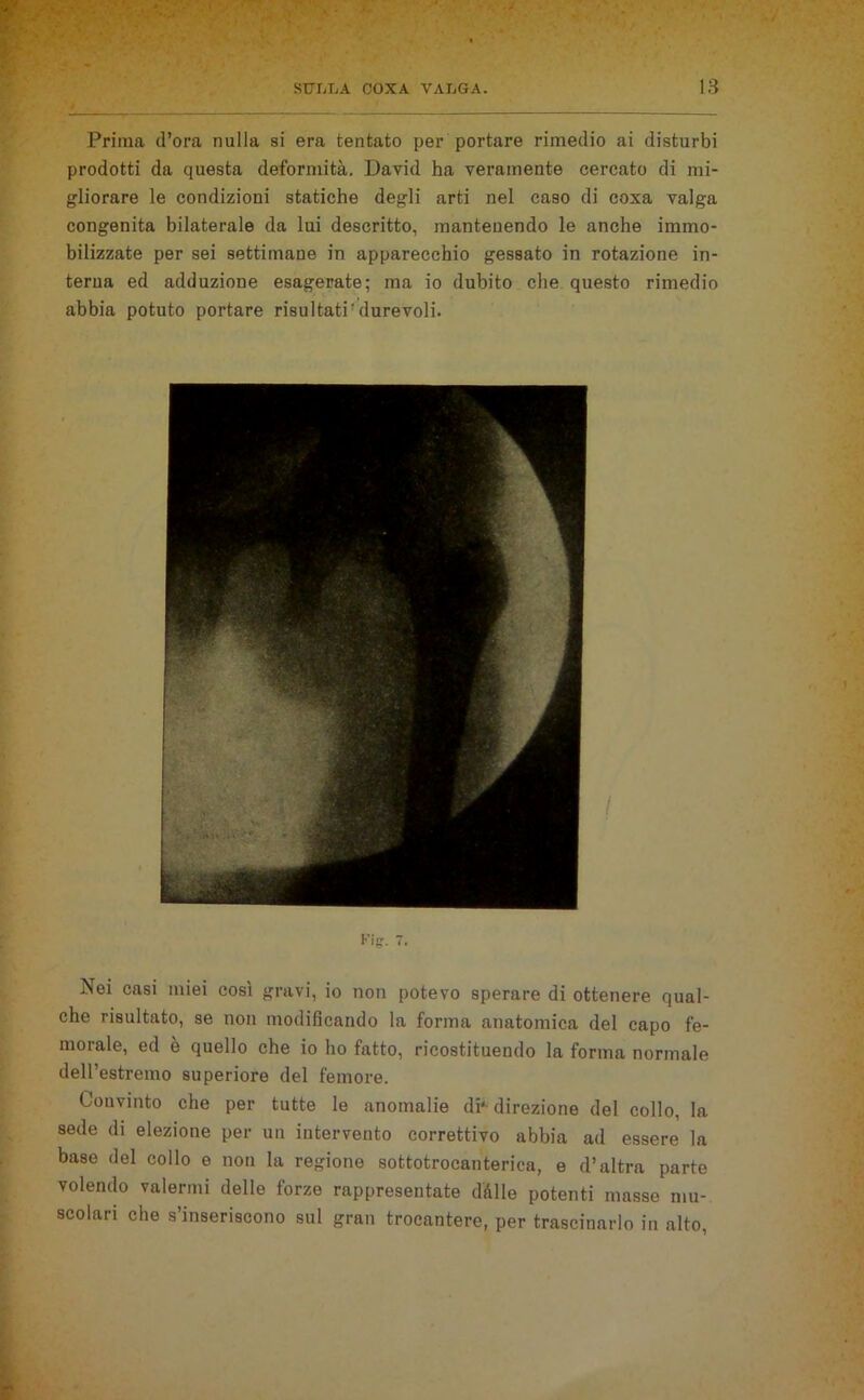 Prima d’ora nulla si era tentato per portare rimedio ai disturbi prodotti da questa deformità. David ha veramente cercato di mi- gliorare le condizioni statiche degli arti nel caso di coxa valga congenita bilaterale da lui descritto, mantenendo le anche immo- bilizzate per sei settimane in apparecchio gessato in rotazione in- terna ed adduzione esagerate; ma io dubito che questo rimedio abbia potuto portare risultati'durevoli. Nei casi miei così gravi, io non potevo sperare di ottenere qual- che risultato, se non modificando la forma anatomica del capo fe- morale, ed è quello che io ho fatto, ricostituendo la forma normale dell’estremo superiore del femore. Convinto che per tutte le anomalie di* direzione del collo, la sede di elezione per un intervento correttivo abbia ad essere la base del collo e non la regione sottotrocanterica, e d’altra parte volendo valermi delle forze rappresentate dàlie potenti masse mu- scolari che s’inseriscono sul gran trocantere, per trascinarlo in alto,